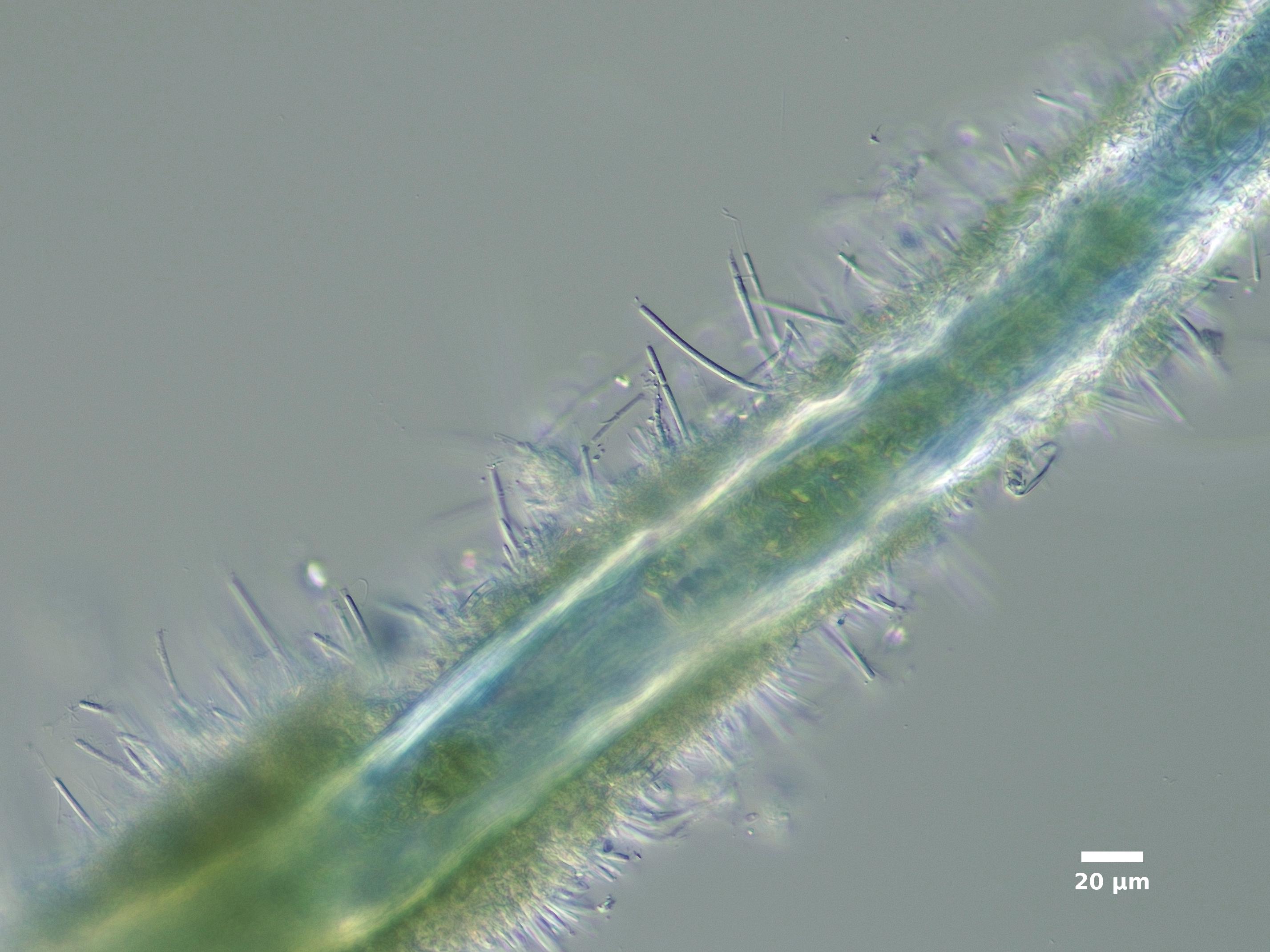 ./Algae/Lake_Chelan/cyanobacteria/chamaesiphon_confervicola_mb_sep29_23_200N_PUTC_EX.jpg