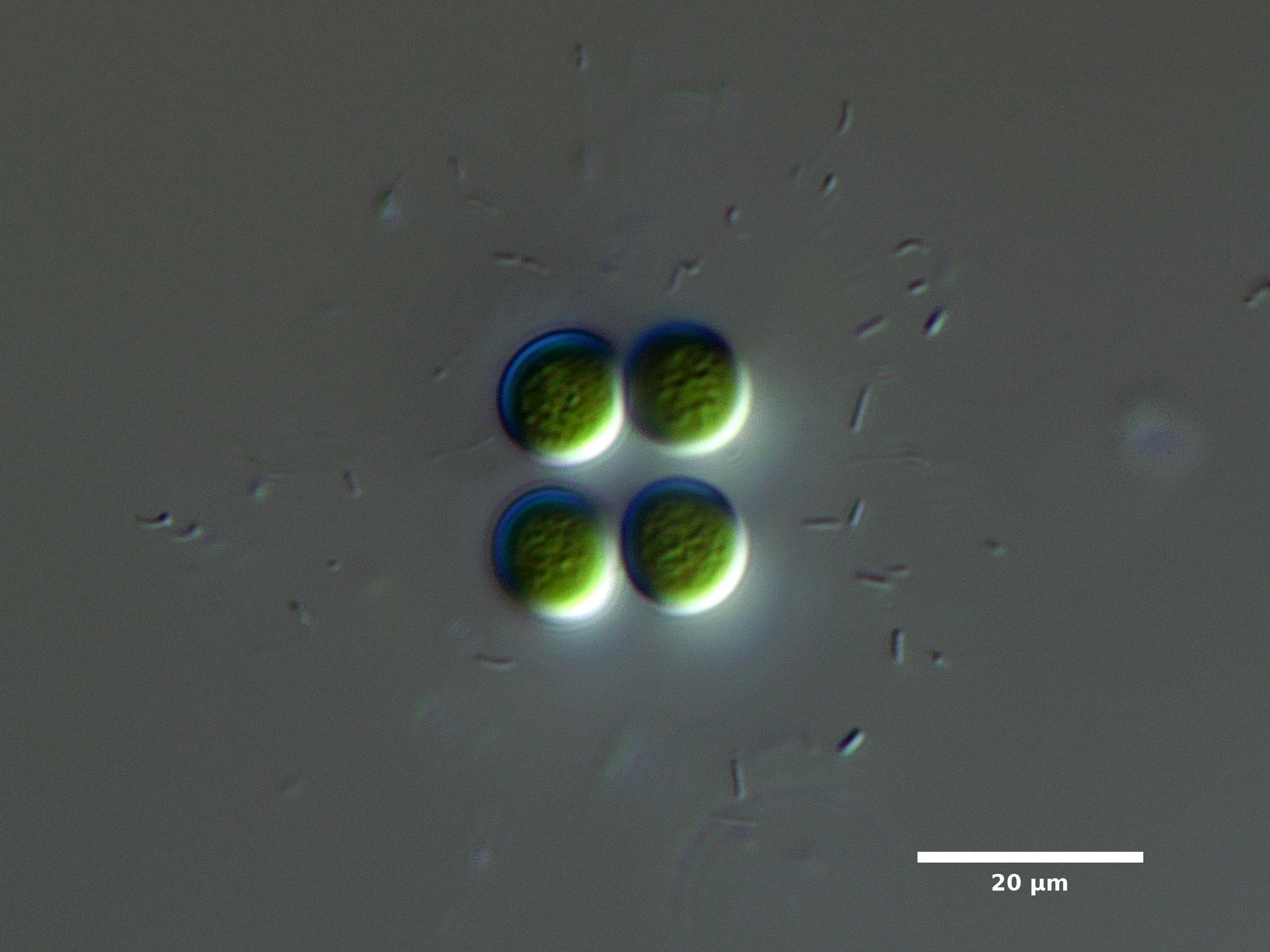 Algae/Lake_Chelan/cyanobacteria/chroococcus_aug29_23_600N_SUN_EX.jpg