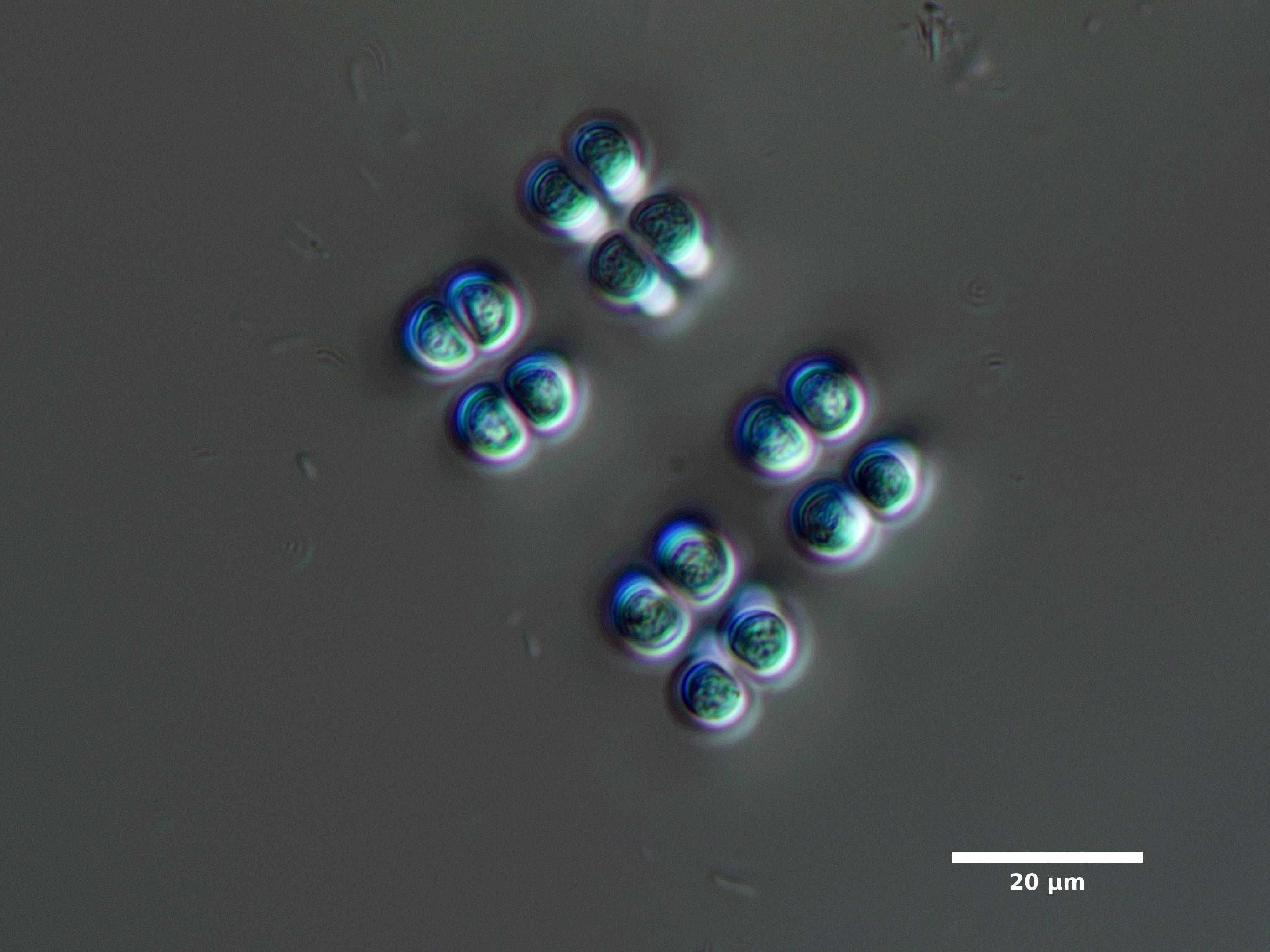 Algae/Lake_Chelan/cyanobacteria/chroococcus_sep29_23_600N_F_SUN_EX.jpg