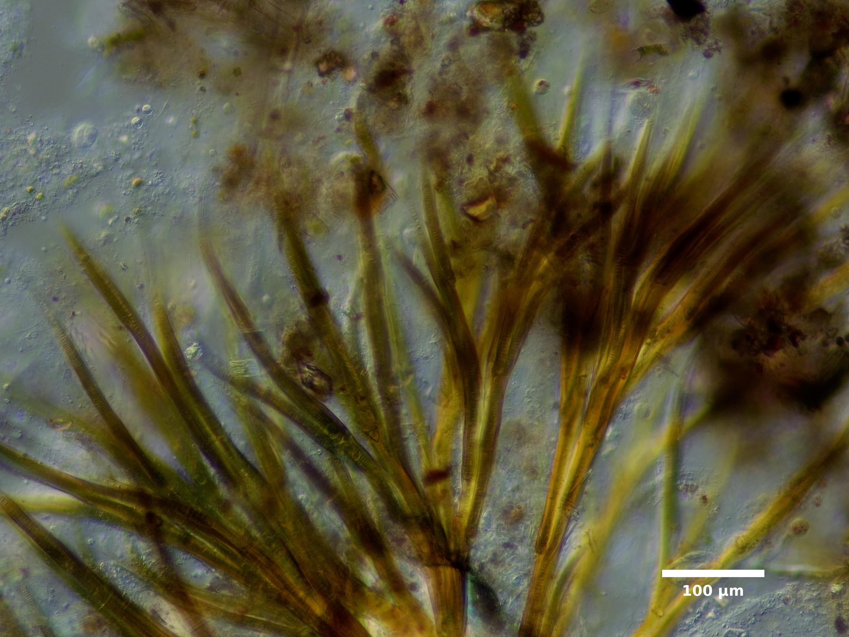 Algae/Lake_Chelan/cyanobacteria/dichothrix_gysophila_sep22_23_100N_CONH_EX.jpg