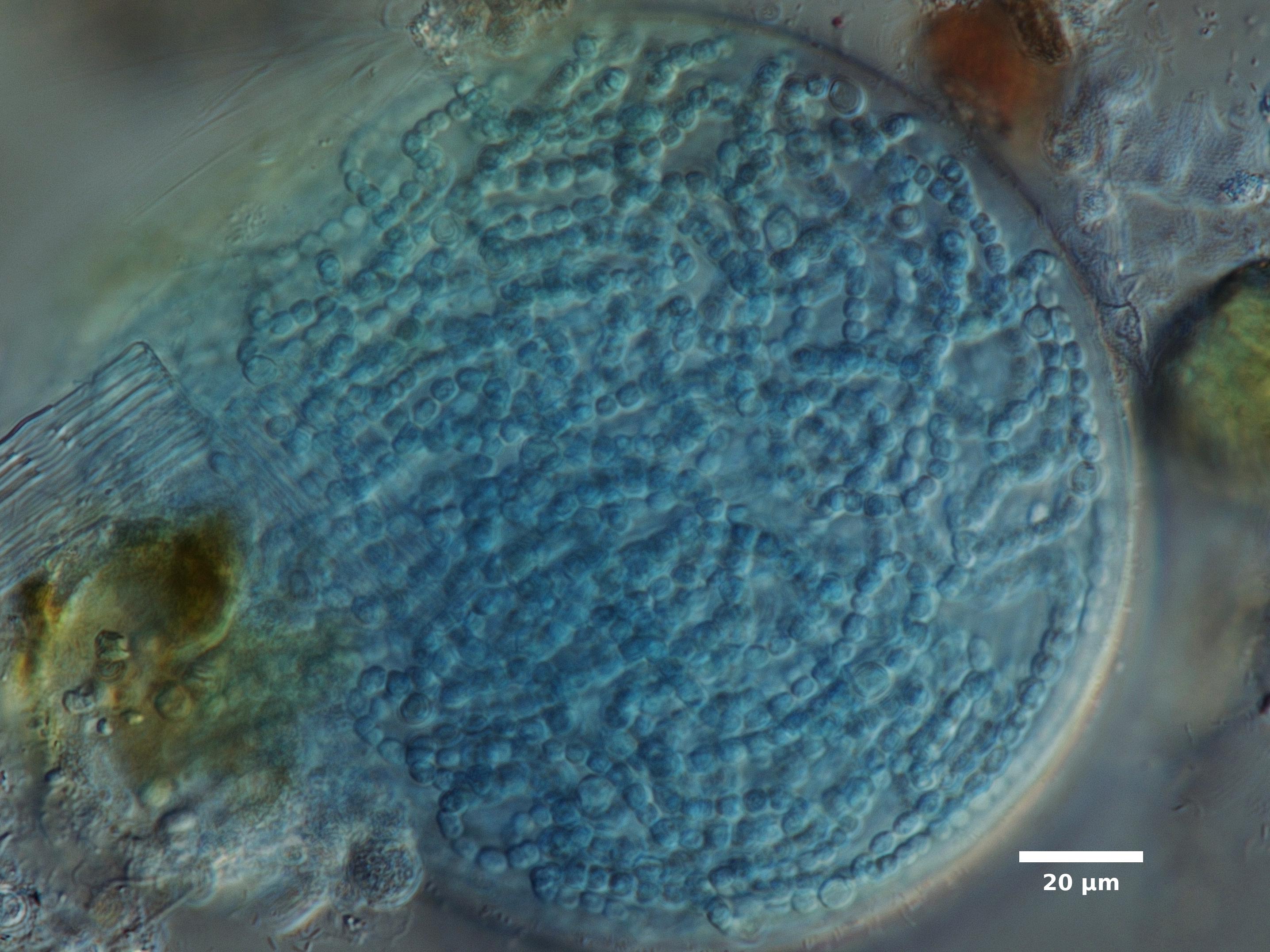 Algae/Lake_Chelan/cyanobacteria/nostoc_sep28_23_400N_F_CONH_EX.jpg