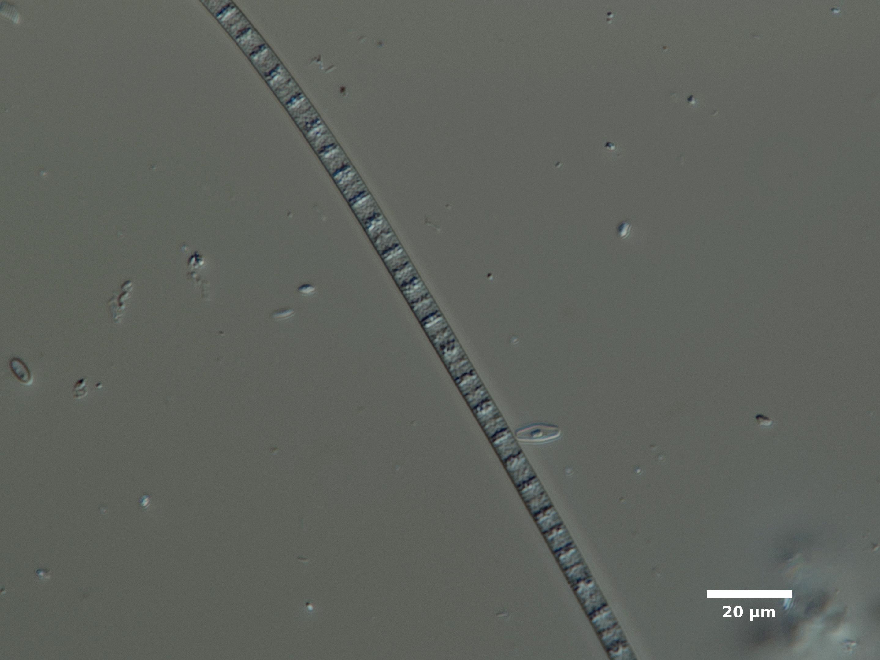 Algae/Lake_Chelan/cyanobacteria/phormidium_sep29_23_400N_F_PURC_EX.jpg