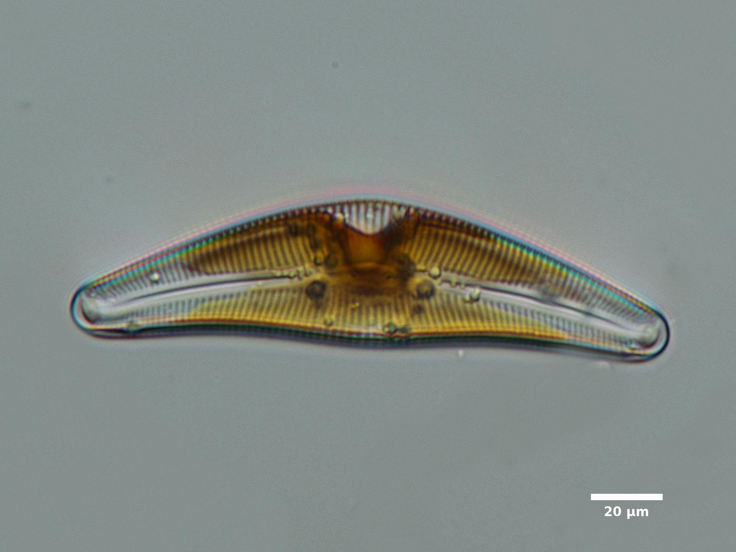Algae/Lake_Chelan/diatoms/cymbella_apr6_18_400N_CRa.jpg