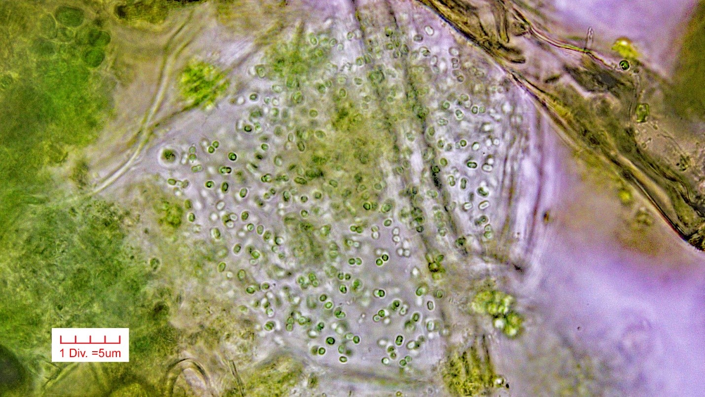 Cyanobacteria/Chroococcales/Aphanothecaceae/Aphanothece/nidulans/5.jpg