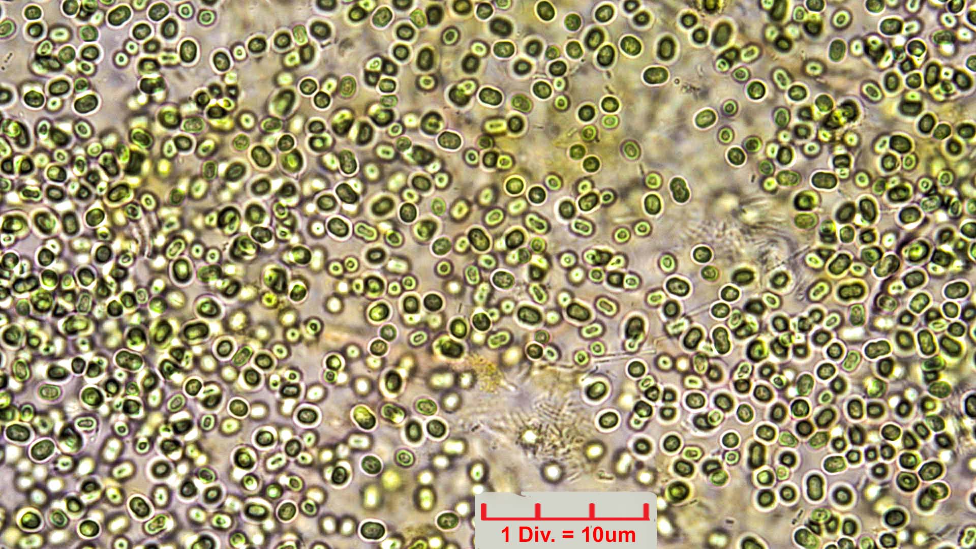 Cyanobacteria/Chroococcales/Aphanothecaceae/Aphanothece/saxicola/10.jpg