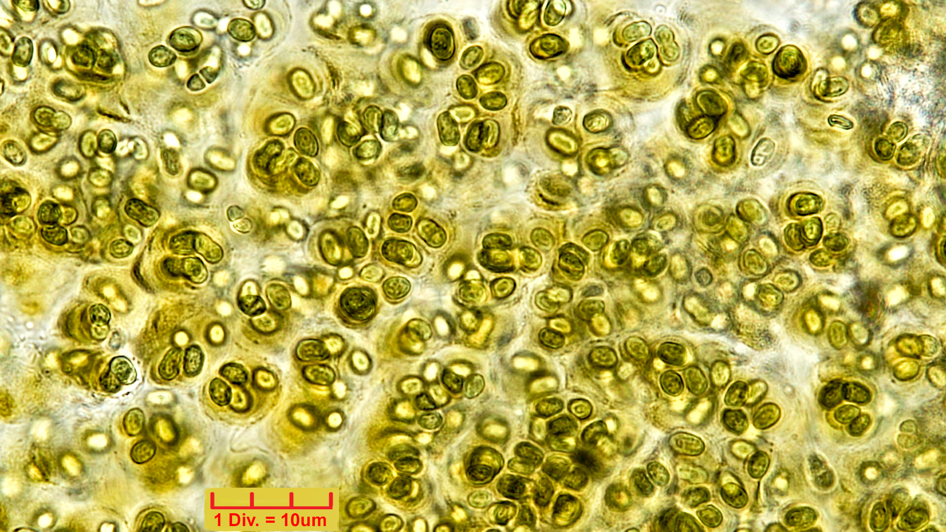 Cyanobacteria/Chroococcales/Aphanothecaceae/Gloeothece/fusco-lutea/12.jpg