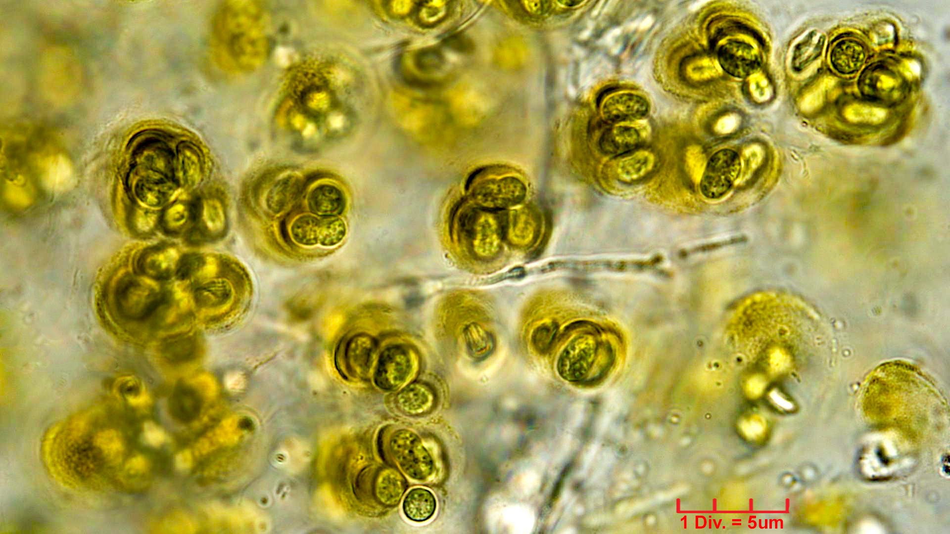 ./././Cyanobacteria/Chroococcales/Aphanothecaceae/Gloeothece/fusco-lutea/14.jpg