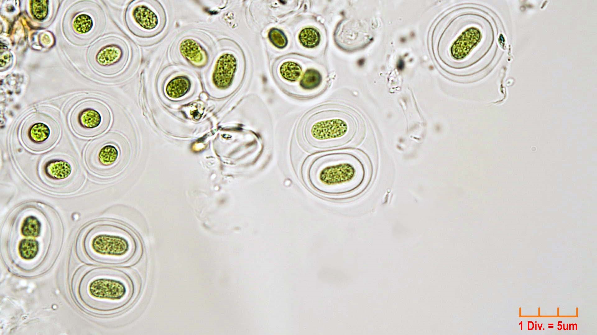 ./././Cyanobacteria/Chroococcales/Aphanothecaceae/Gloeothece/rupestris/16.jpg