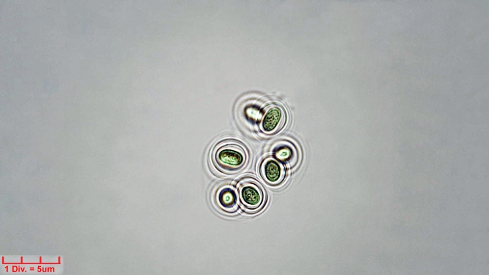././Cyanobacteria/Chroococcales/Aphanothecaceae/Gloeothece/rupestris/17d.jpg
