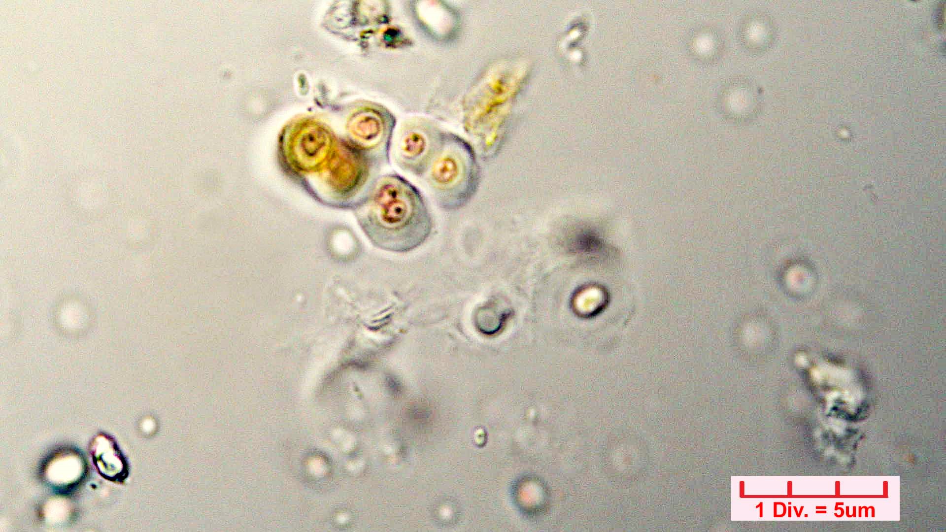 Cyanobacteria/Chroococcales/Chroococcaceae/Gloeocapsa/biformis/40.jpg