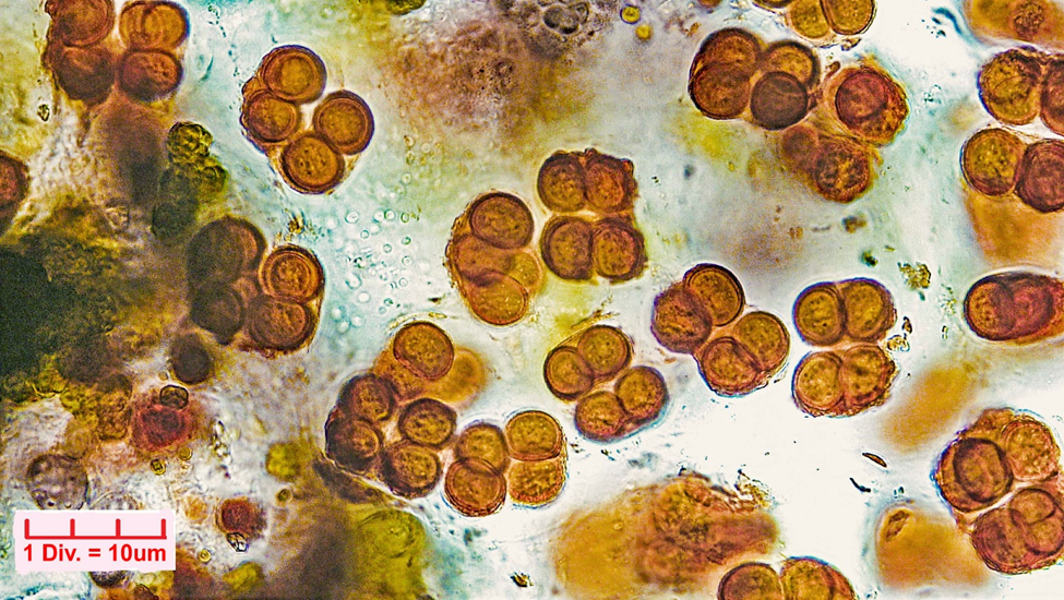 Cyanobacteria/Chroococcales/Chroococcaceae/Gloeocapsa/rupestris/36.png