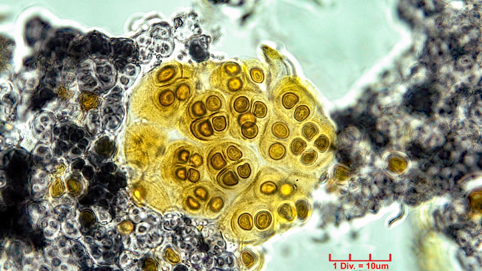 Cyanobacteria/Chroococcales/Chroococcaceae/Gloeocapsopsis/pleurocapsoides/52.png