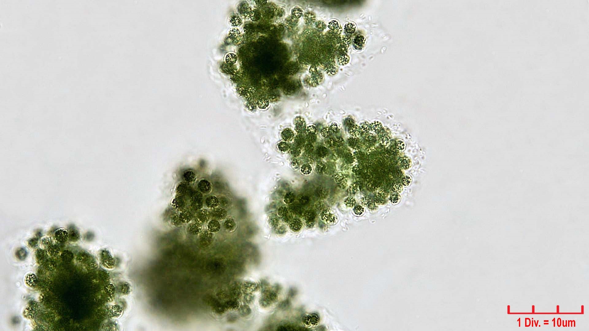 Cyanobacteria/Chroococcales/Microcystaceae/Microcystis/viridis/66.jpg
