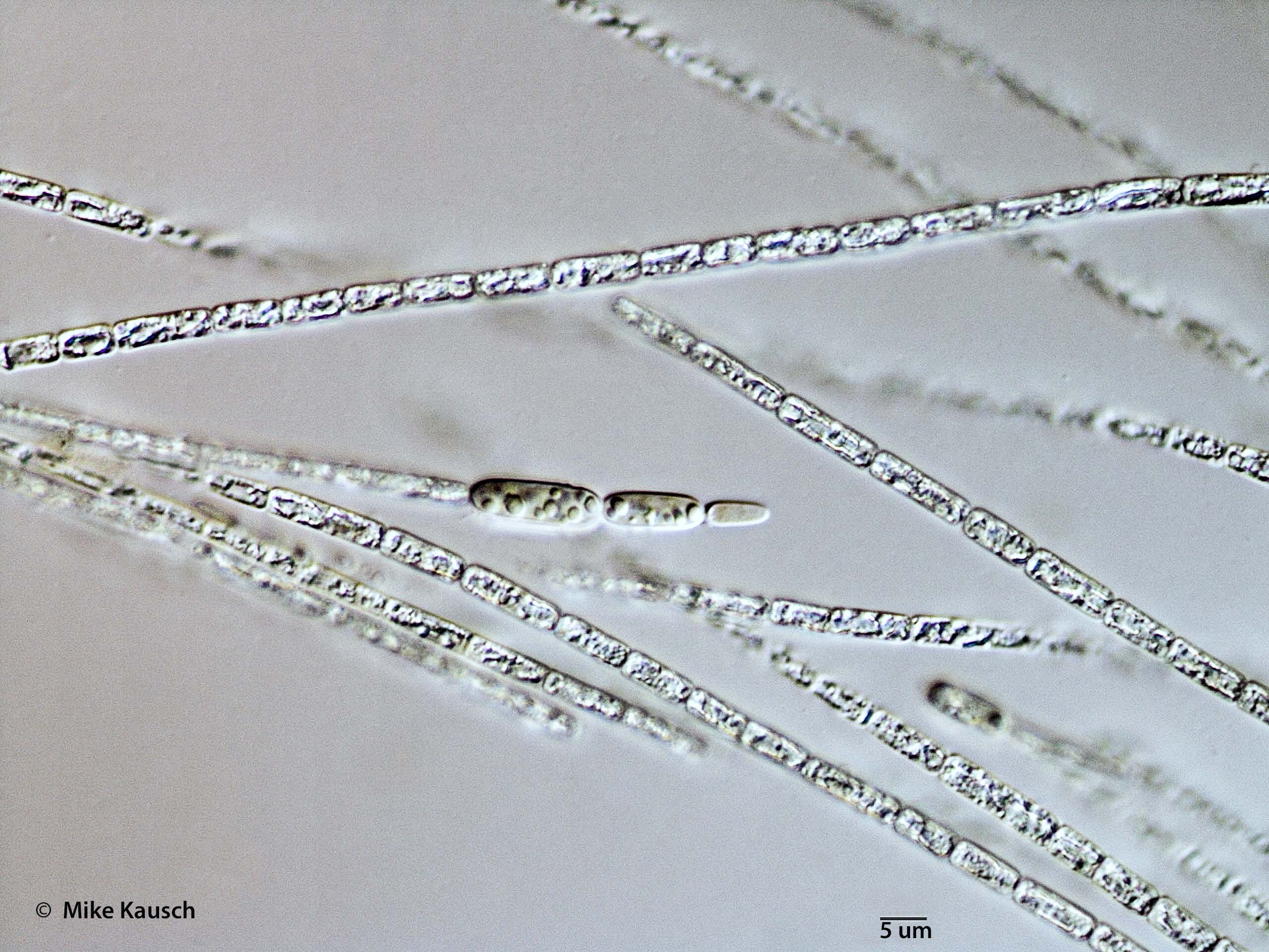 ././Cyanobacteria/Nostocales/Aphanizomenonaceae/Cylindrospermopsis/raciborskii/582.jpg