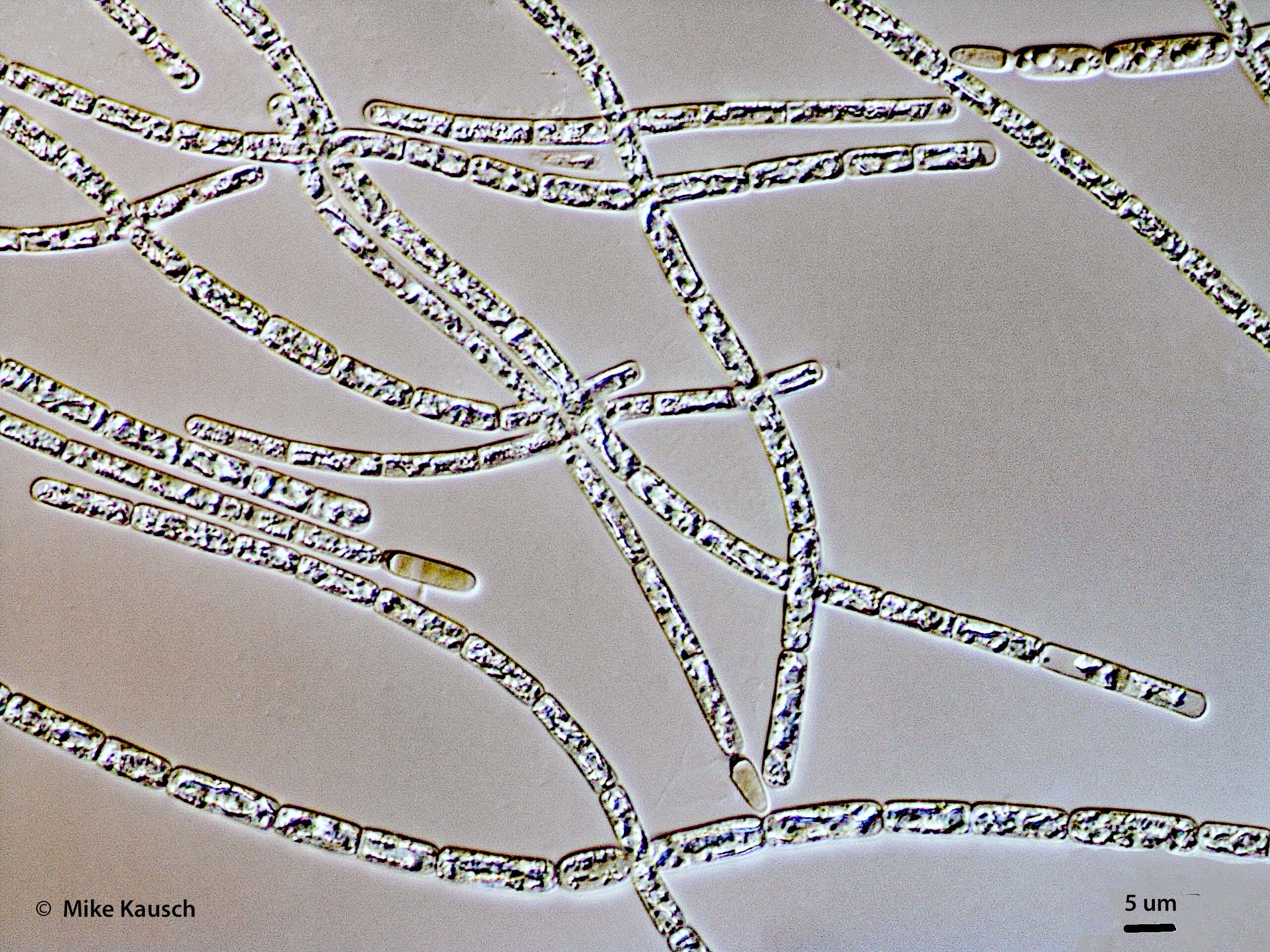 Cyanobacteria/Nostocales/Aphanizomenonaceae/Cylindrospermopsis/raciborskii/583.jpg