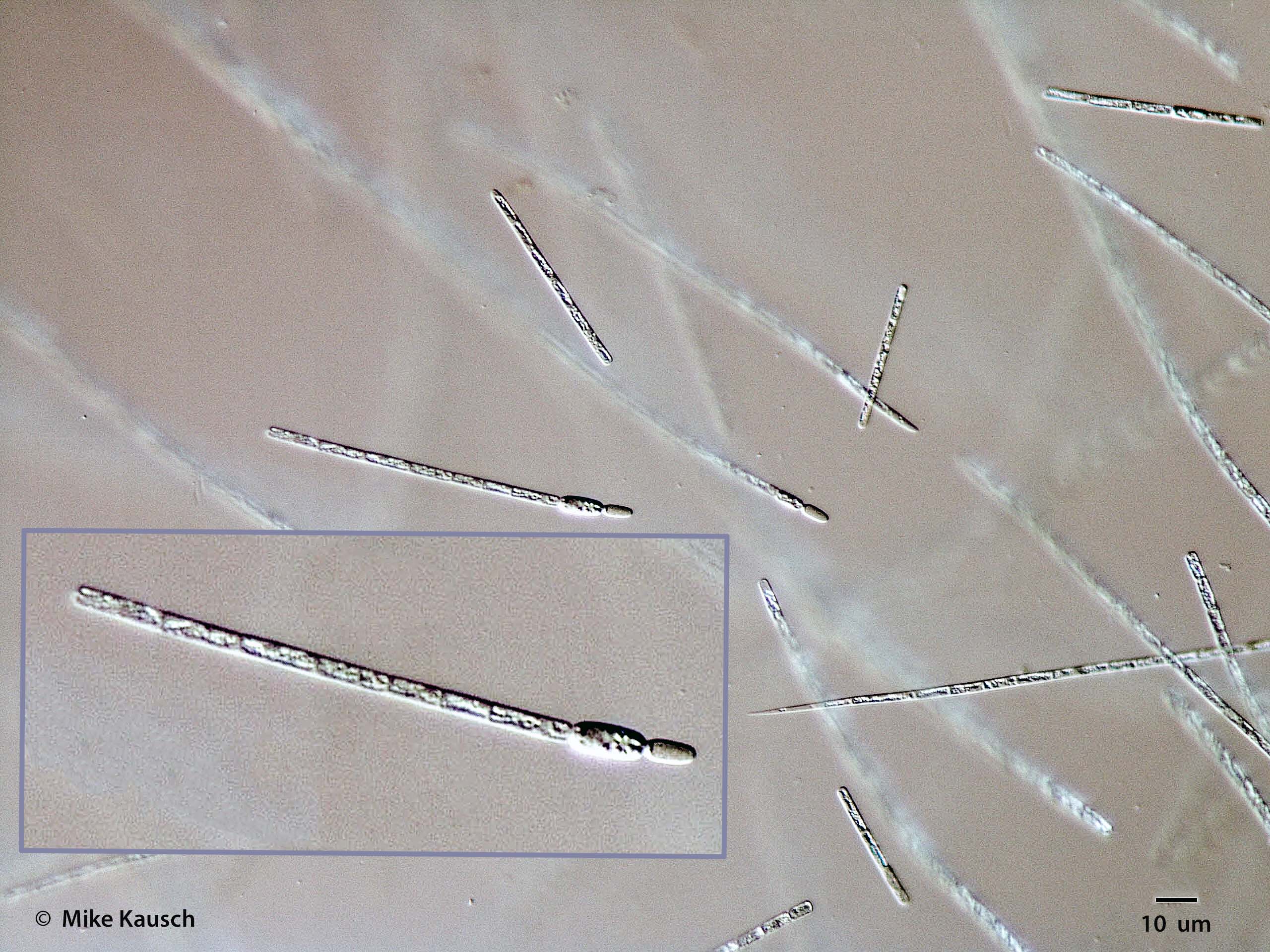 Cyanobacteria/Nostocales/Aphanizomenonaceae/Cylindrospermopsis/raciborskii/584.jpg