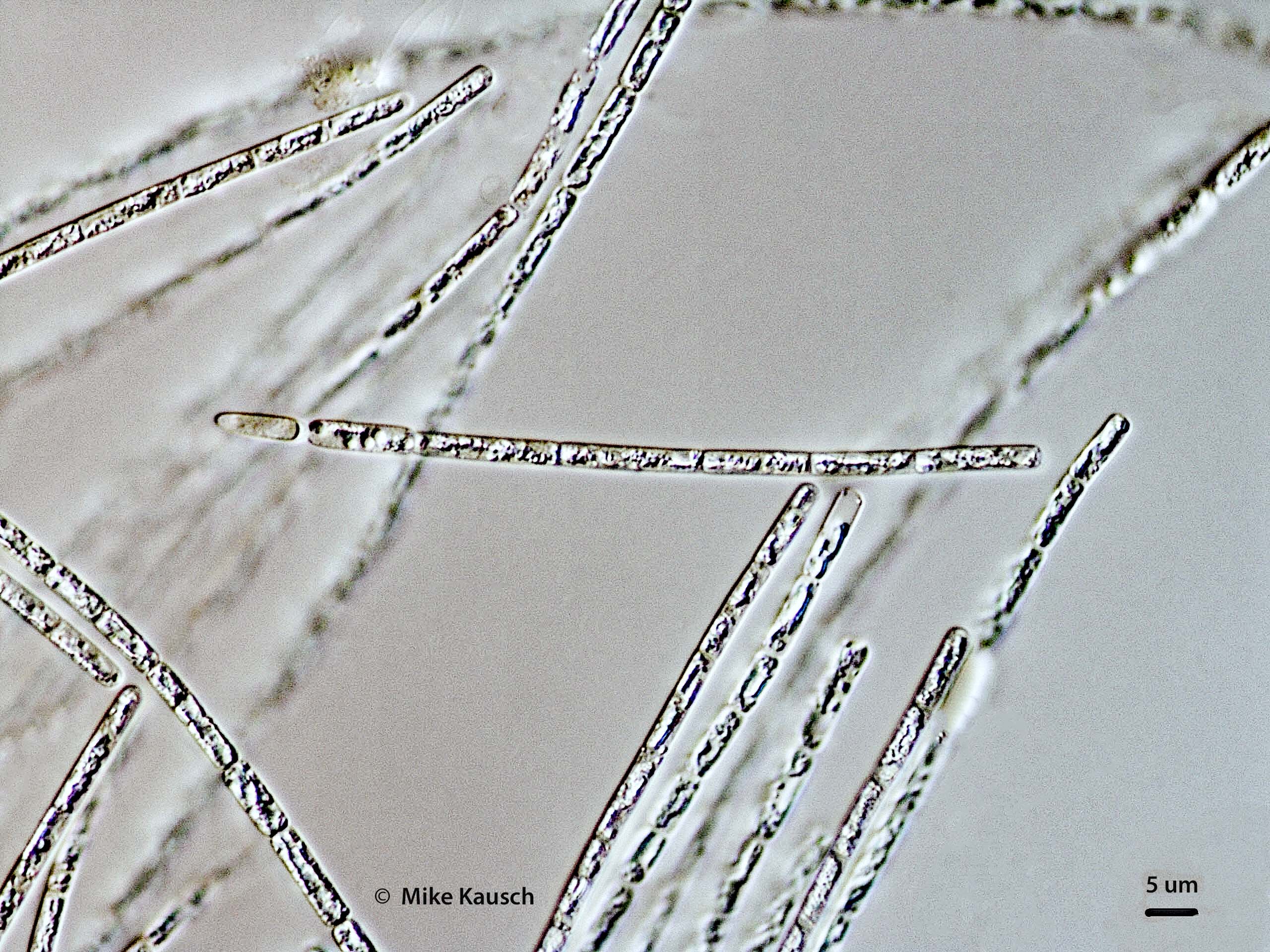 Cyanobacteria/Nostocales/Aphanizomenonaceae/Cylindrospermopsis/raciborskii/585.jpg