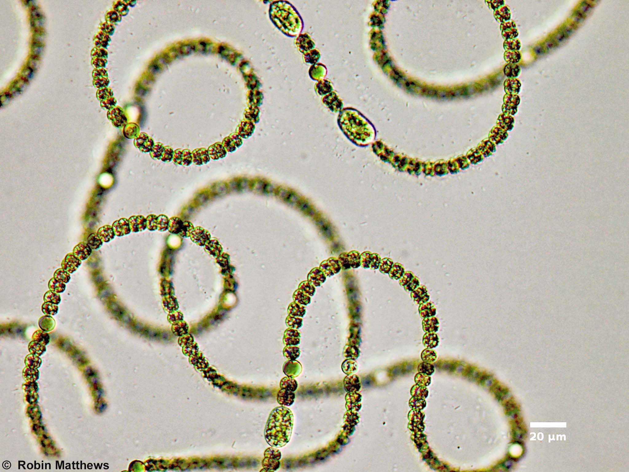 Cyanobacteria/Nostocales/Aphanizomenonaceae/Dolichospermum/circinale/556.jpg