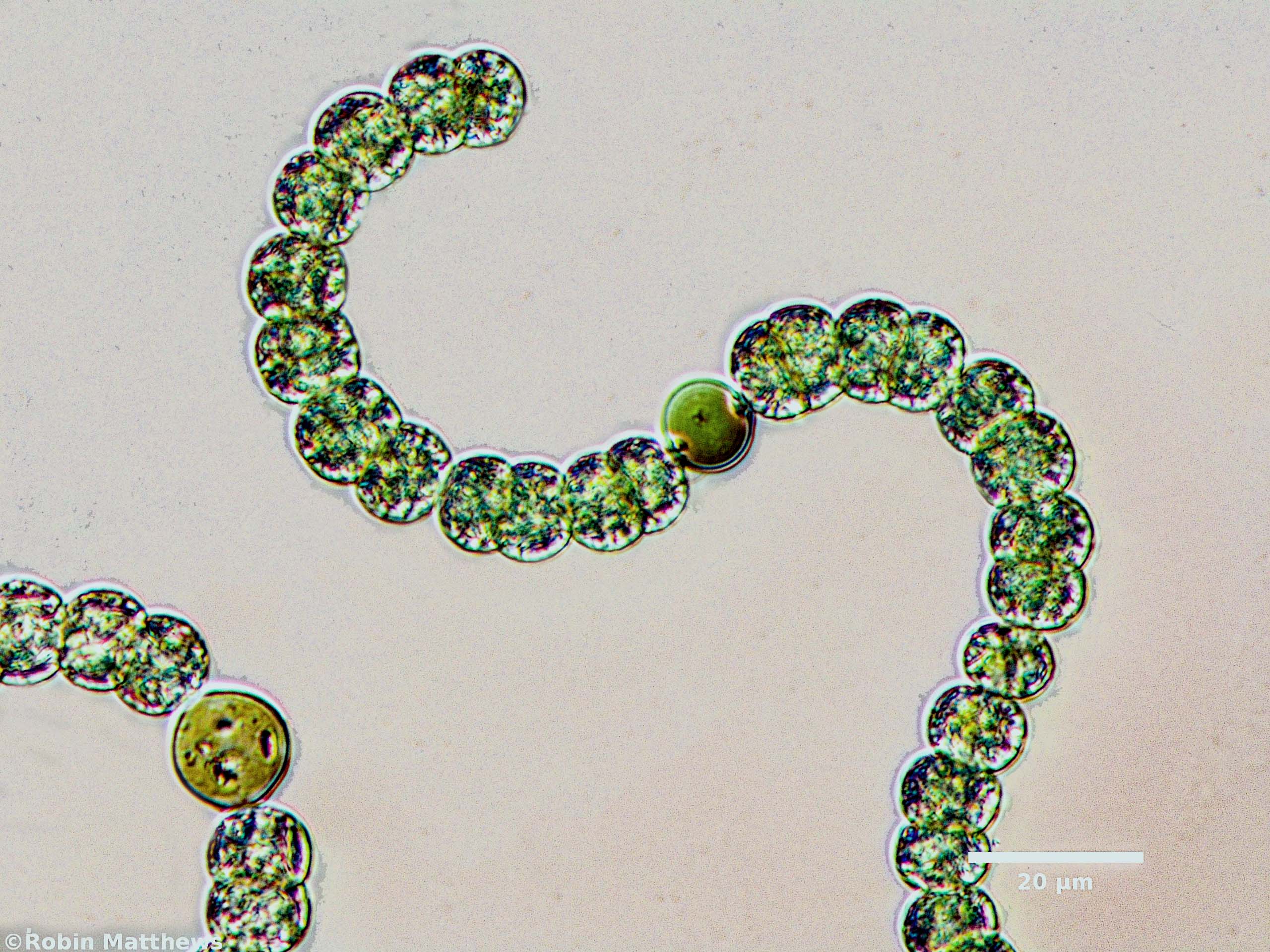 Cyanobacteria/Nostocales/Aphanizomenonaceae/Dolichospermum/crassum/559.jpg