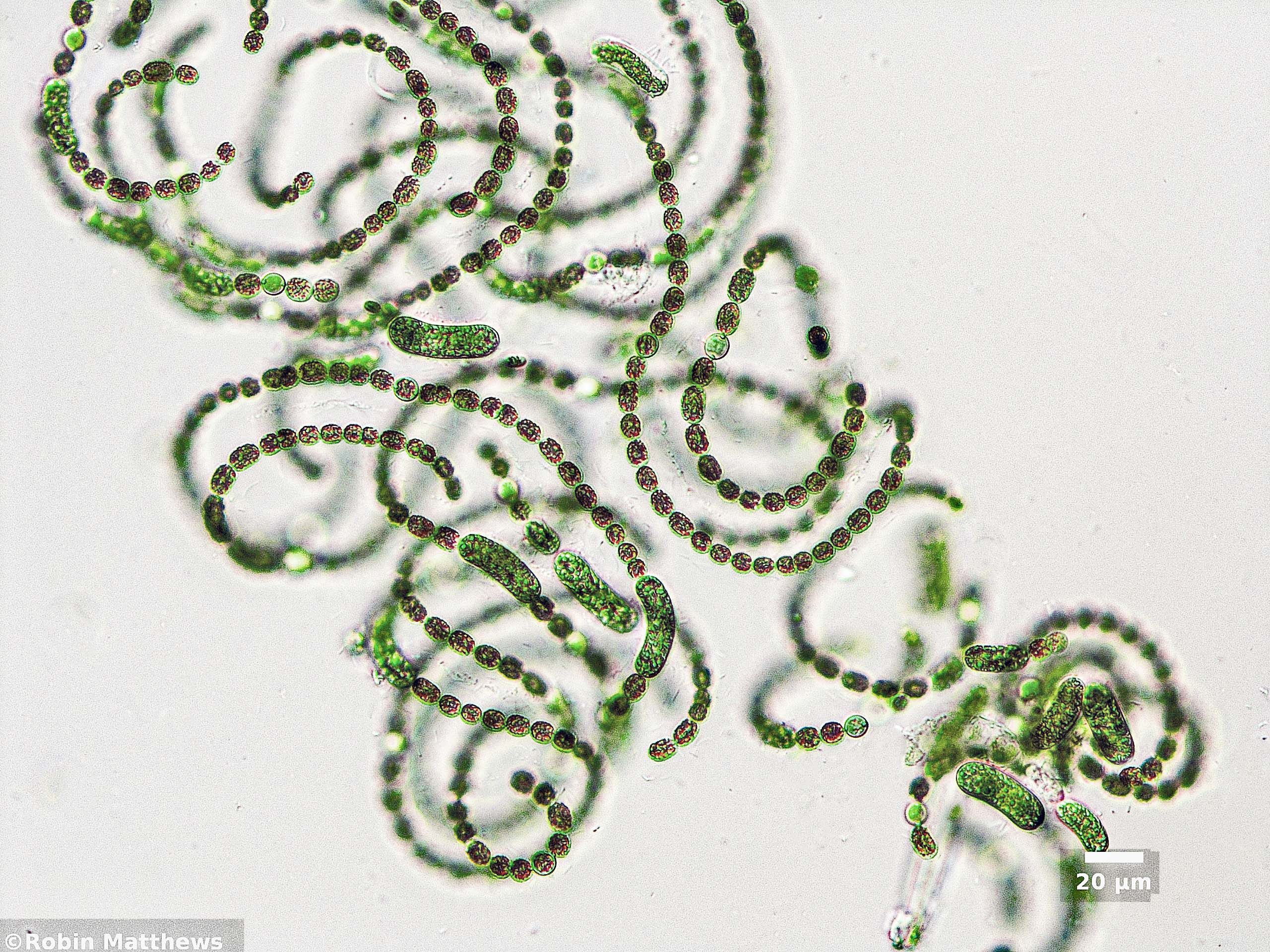 Cyanobacteria/Nostocales/Aphanizomenonaceae/Dolichospermum/ellipsoides/564.jpg