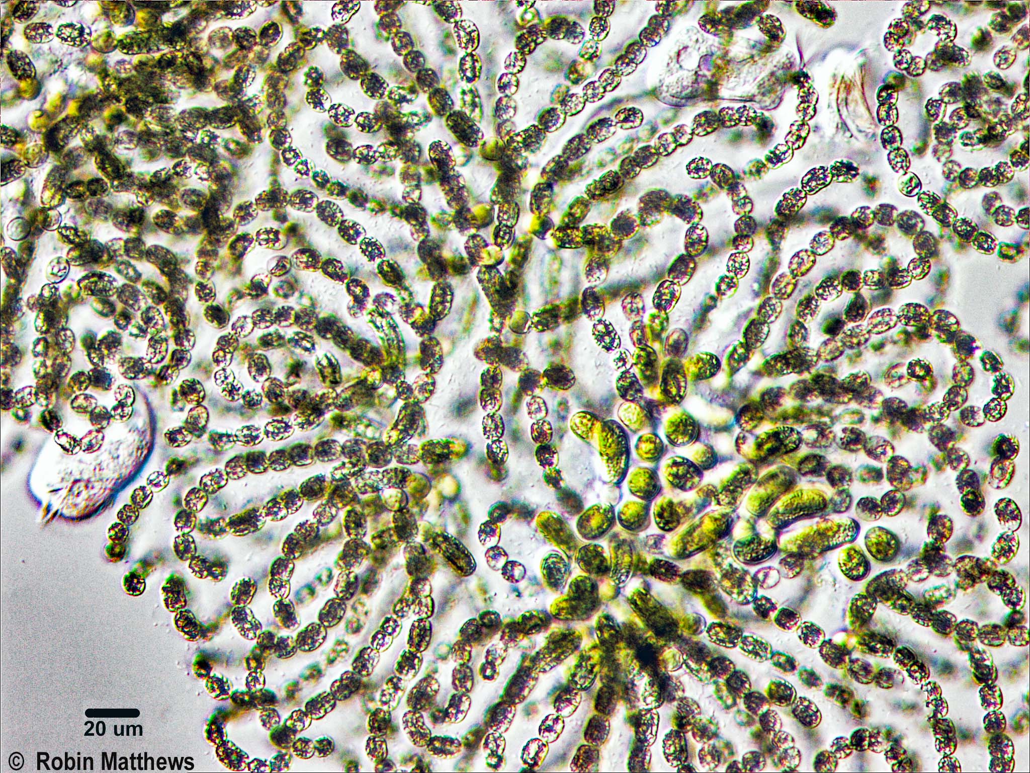 Cyanobacteria/Nostocales/Aphanizomenonaceae/Dolichospermum/lemmermannii/570.jpg