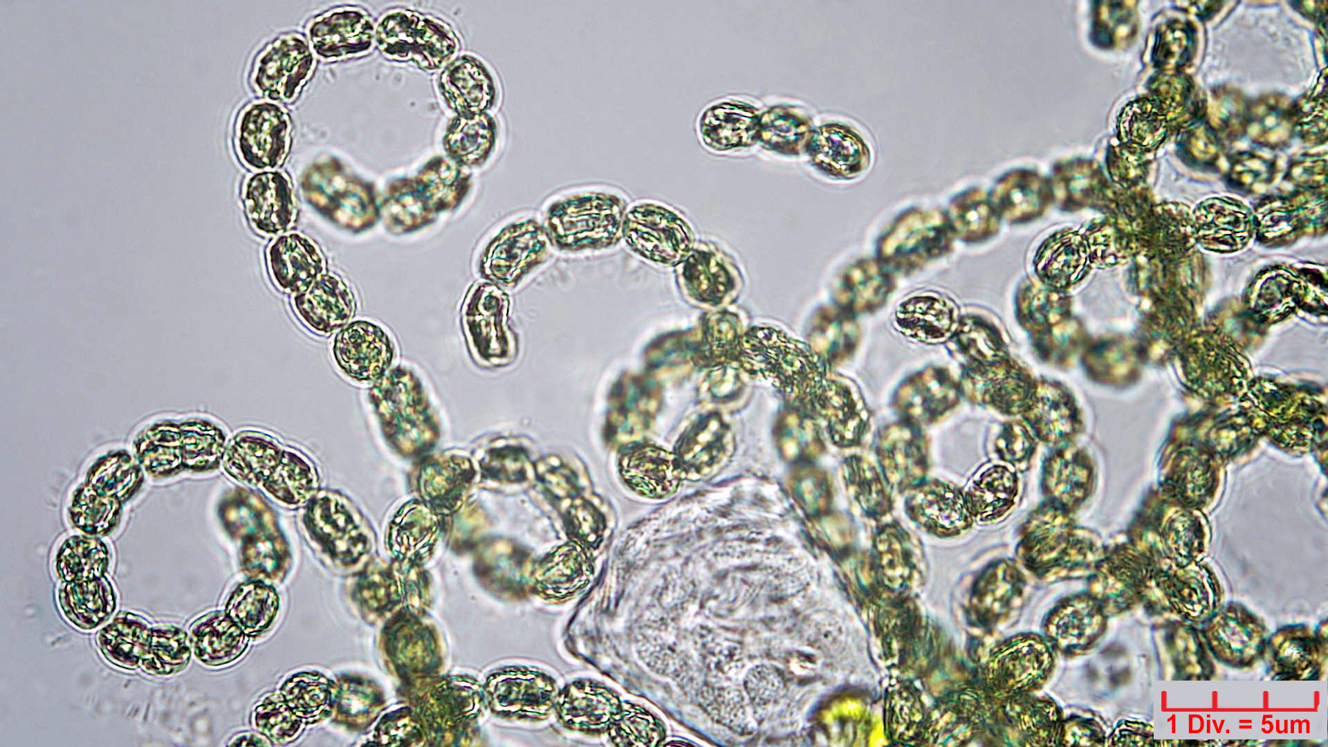Cyanobacteria/Nostocales/Aphanizomenonaceae/Dolichospermum/lemmermannii/574.jpg