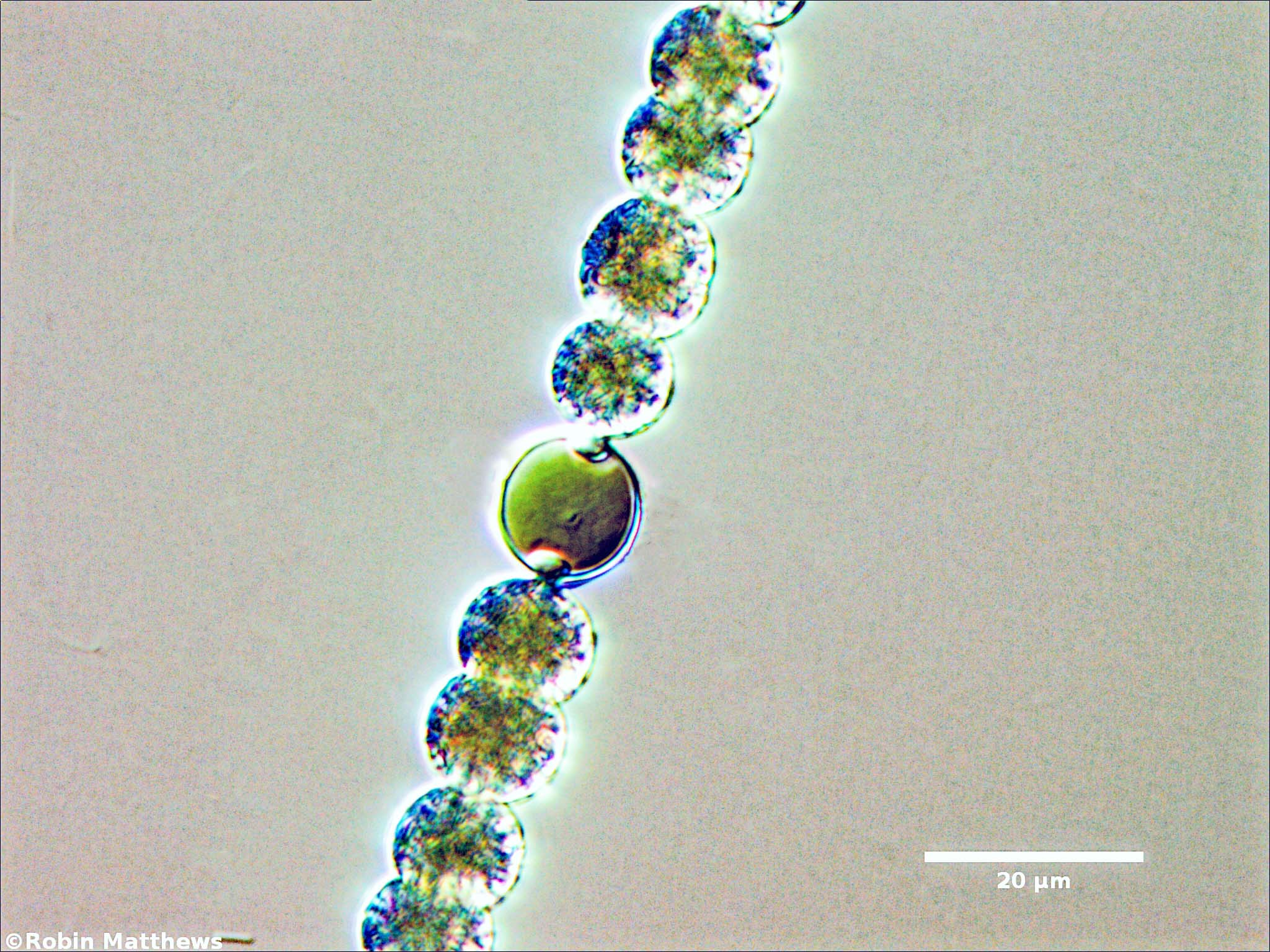 Cyanobacteria/Nostocales/Aphanizomenonaceae/Dolichospermum/planctonicum/577.jpg