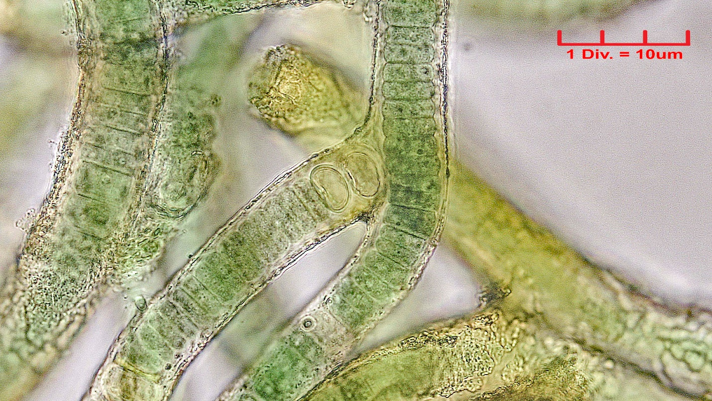 Cyanobacteria/Nostocales/Tolypothrichaceae/Hassalia/byssoidea/323.png