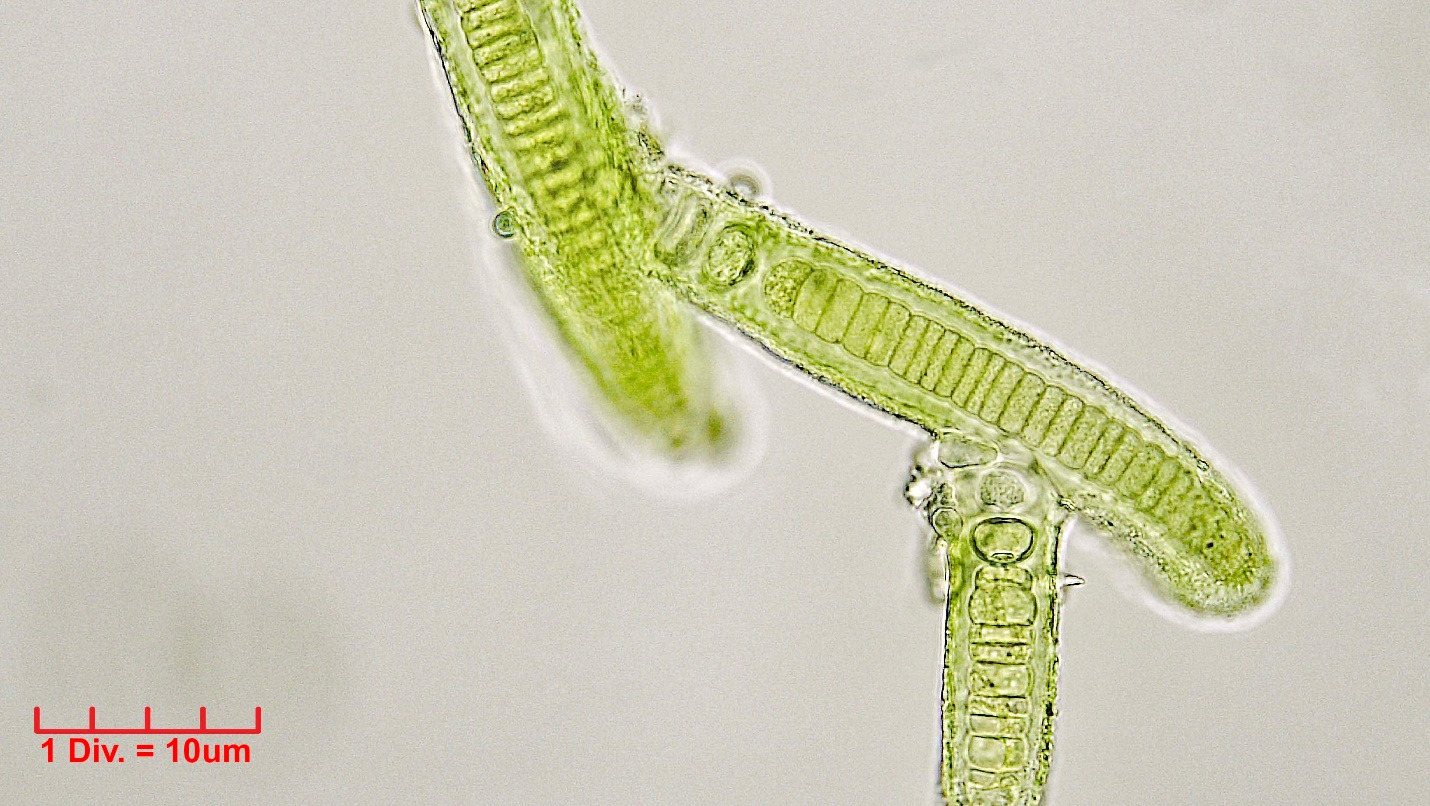 Cyanobacteria/Nostocales/Tolypothrichaceae/Hassalia/byssoidea/324.png