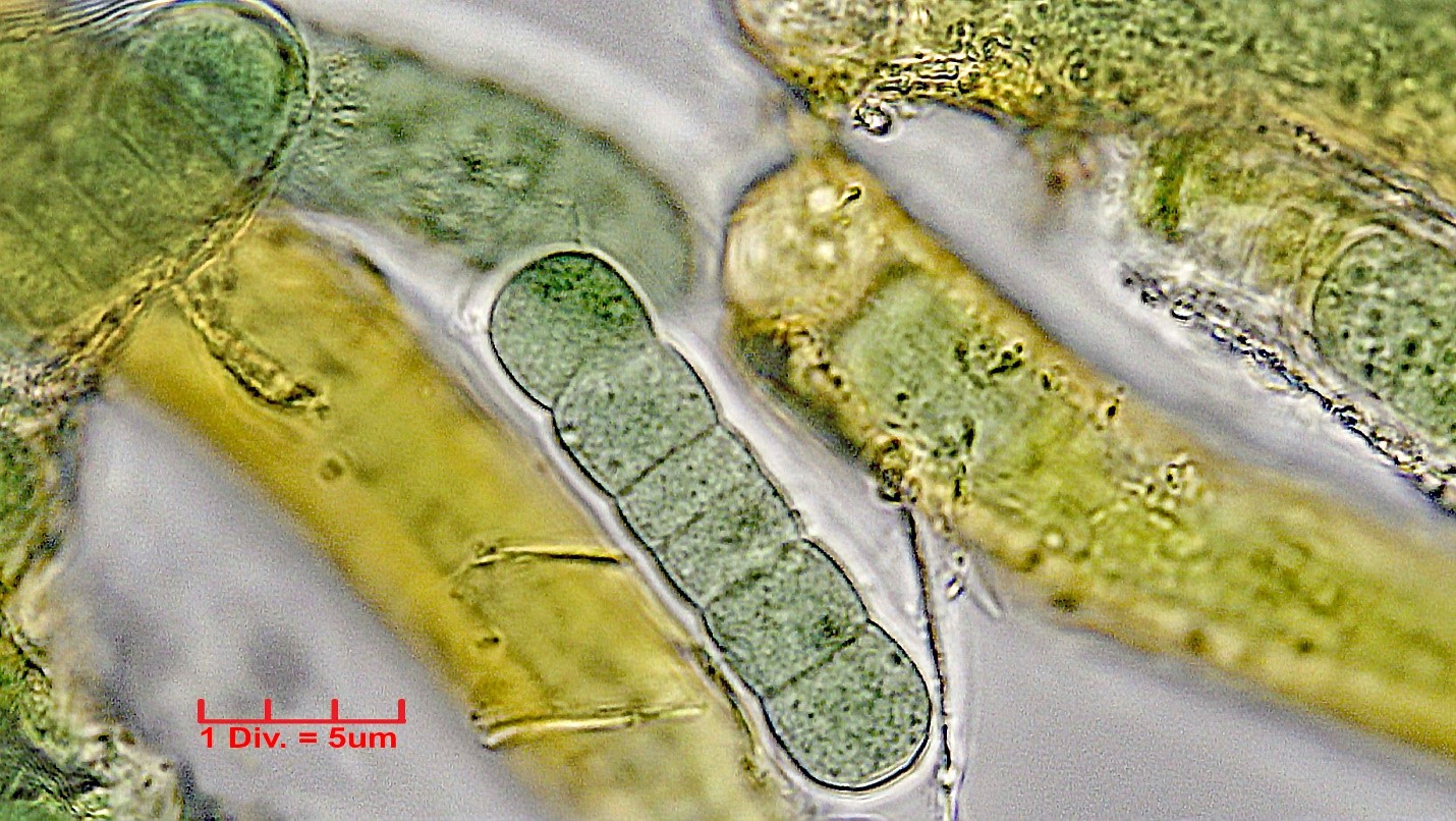 ./Cyanobacteria/Nostocales/Tolypothrichaceae/Hassalia/byssoidea/325.jpg