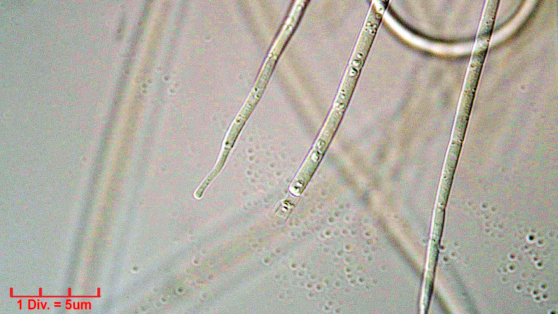 ./././Cyanobacteria/Oscillatoriales/Coleofasciculaceae/Geitlerinema/splendidum/294.jpg