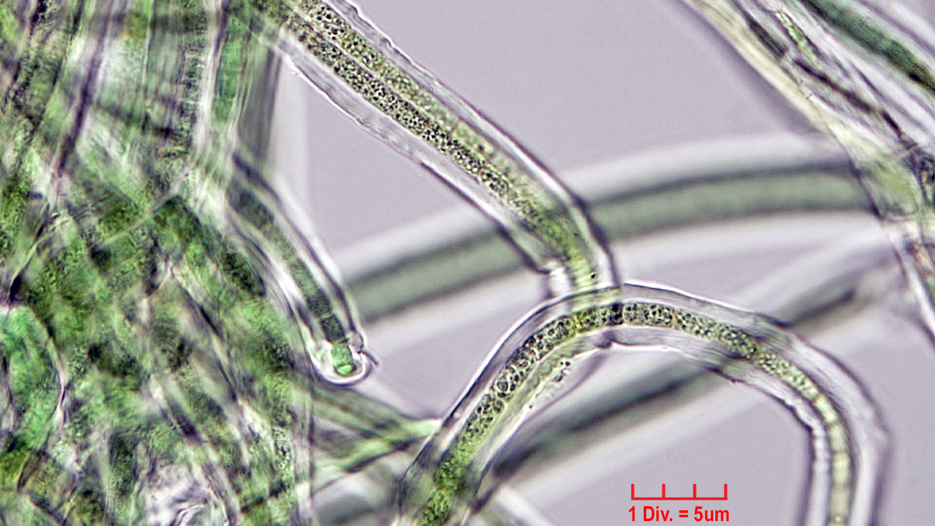 Cyanobacteria/Oscillatoriales/Microcoleaceae/Symplocastrum/friesii/Symfri2.jpg