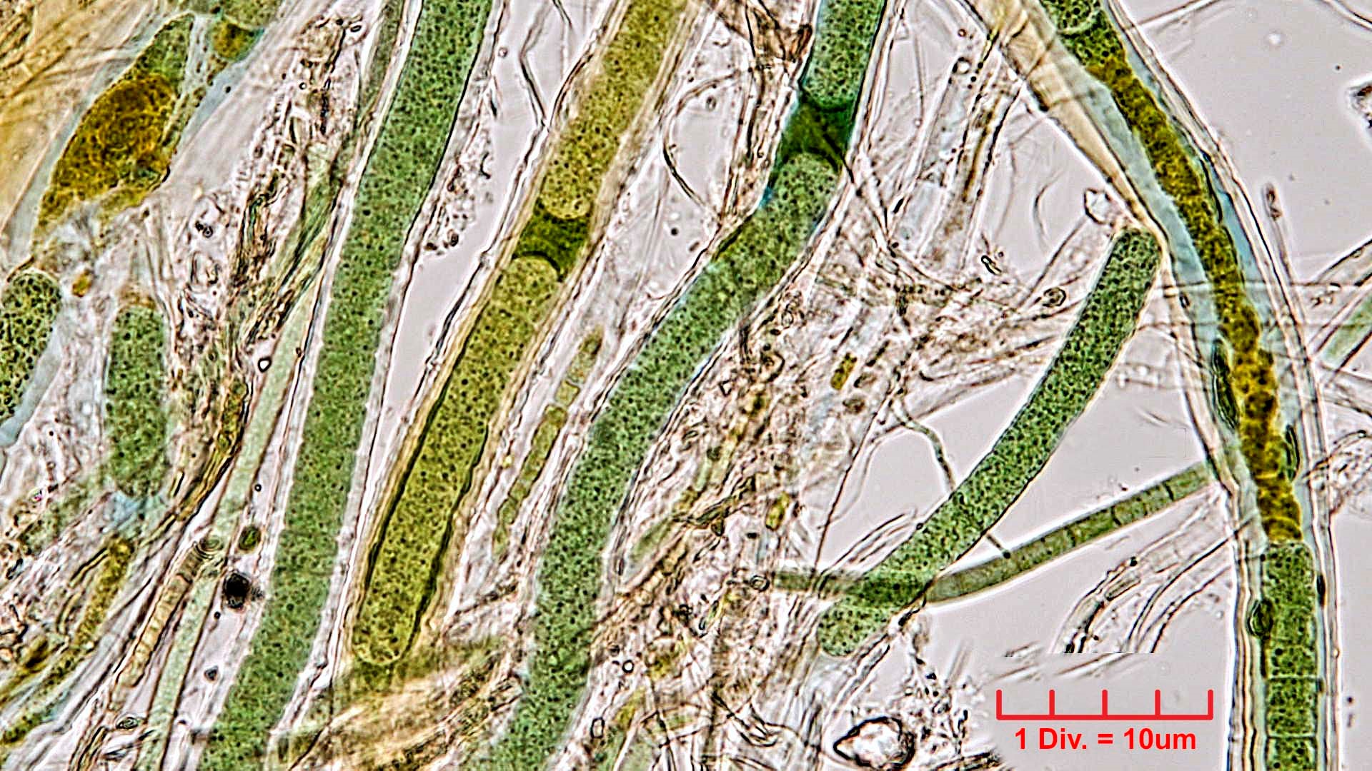 ./Cyanobacteria/Oscillatoriales/Microcoleaceae/Symplocastrum/muelleri/278.jpg