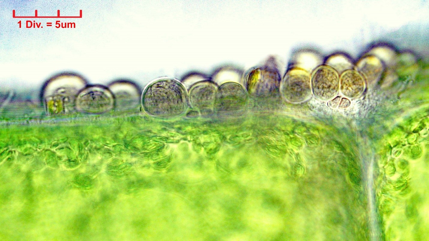 ././Cyanobacteria/Pleurocapsales/Dermocarpellaceae/Cyanocystis/hemisphaerica/157.jpg