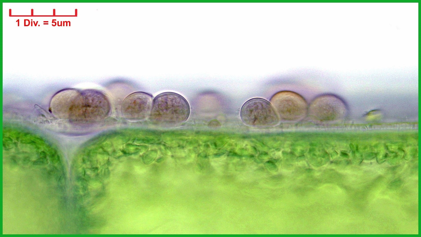./././Cyanobacteria/Pleurocapsales/Dermocarpellaceae/Cyanocystis/hemisphaerica/158.jpg