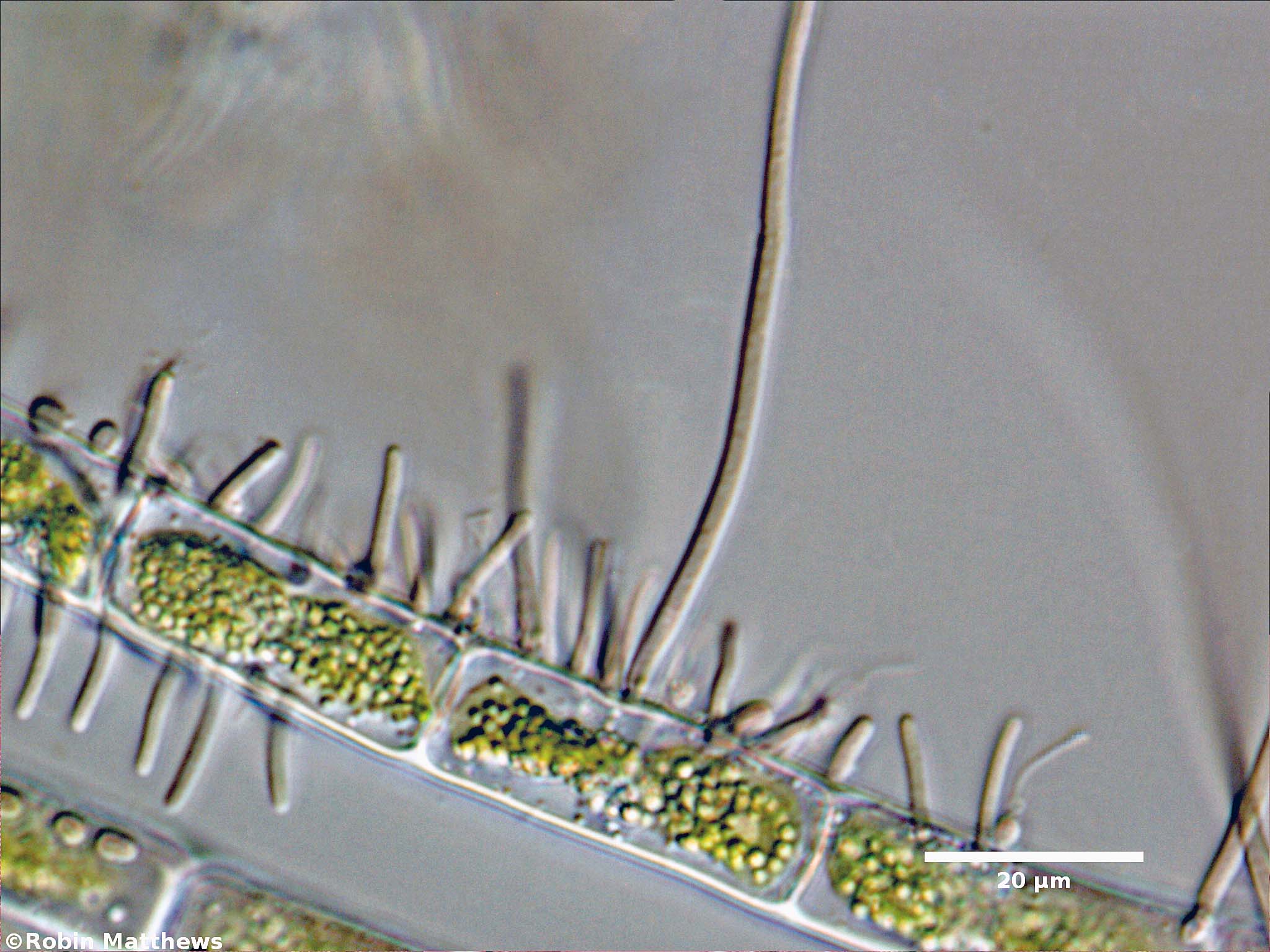 ./././Cyanobacteria/Synechococcales/Chamaesiphonaceae/Cyanophanon/mirable/91.jpg