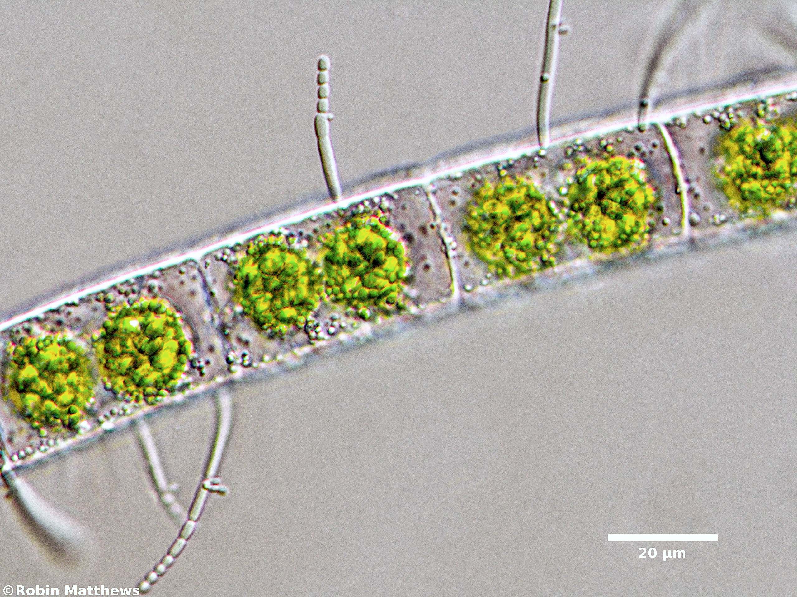 ./Cyanobacteria/Synechococcales/Chamaesiphonaceae/Cyanophanon/sp/86.jpg