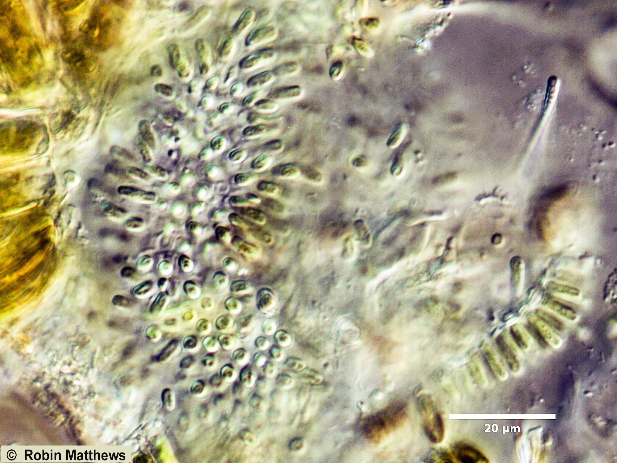 ./././Cyanobacteria/Synechococcales/Chamaesiphonaceae/Geitlerbactron/periphyticum/92.jpg