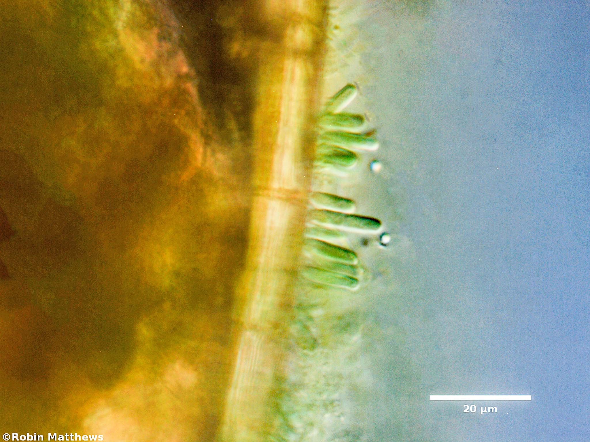 Cyanobacteria/Synechococcales/Chamaesiphonaceae/Geitlerbactron/periphyticum/97.jpg