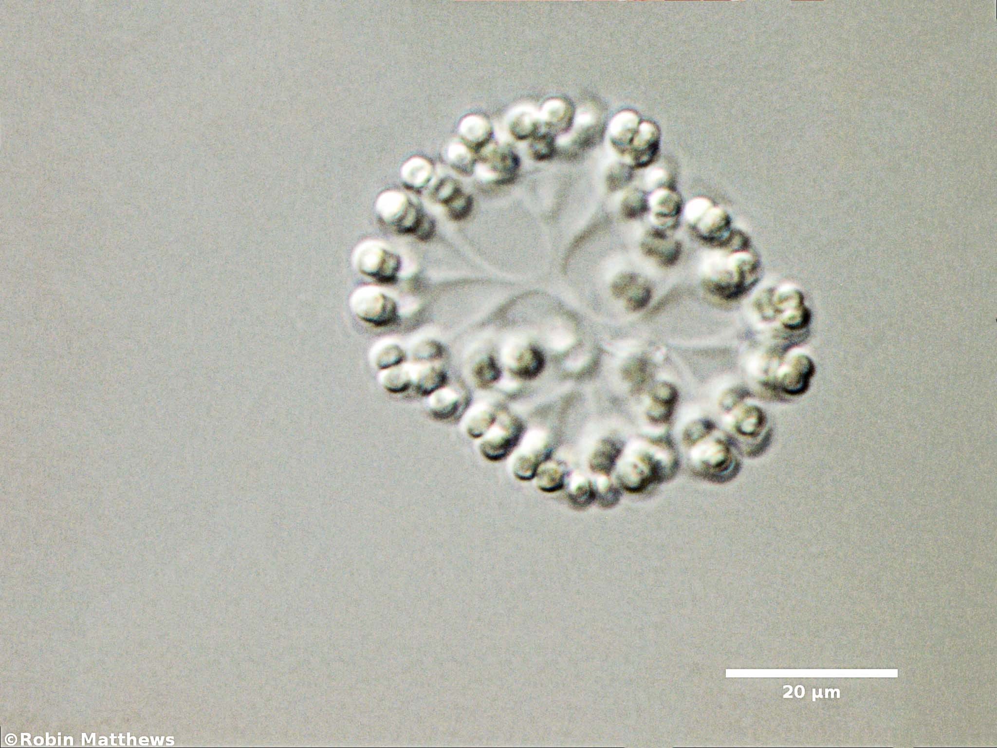 Cyanobacteria/Synechococcales/Coleosphaeriaceae/Snowella/litoralis/102.jpg