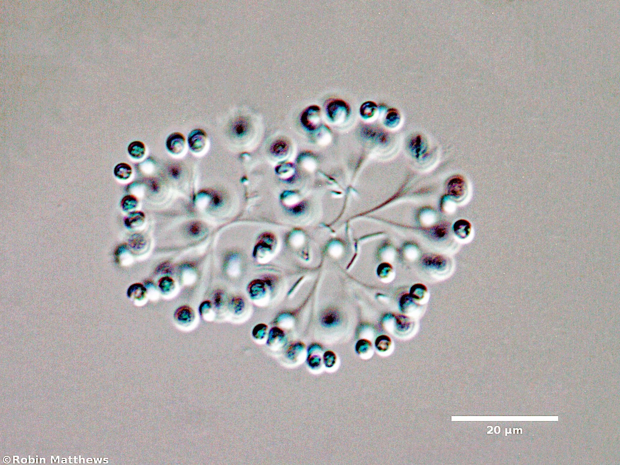 Cyanobacteria/Synechococcales/Coleosphaeriaceae/Snowella/litoralis/103.jpg