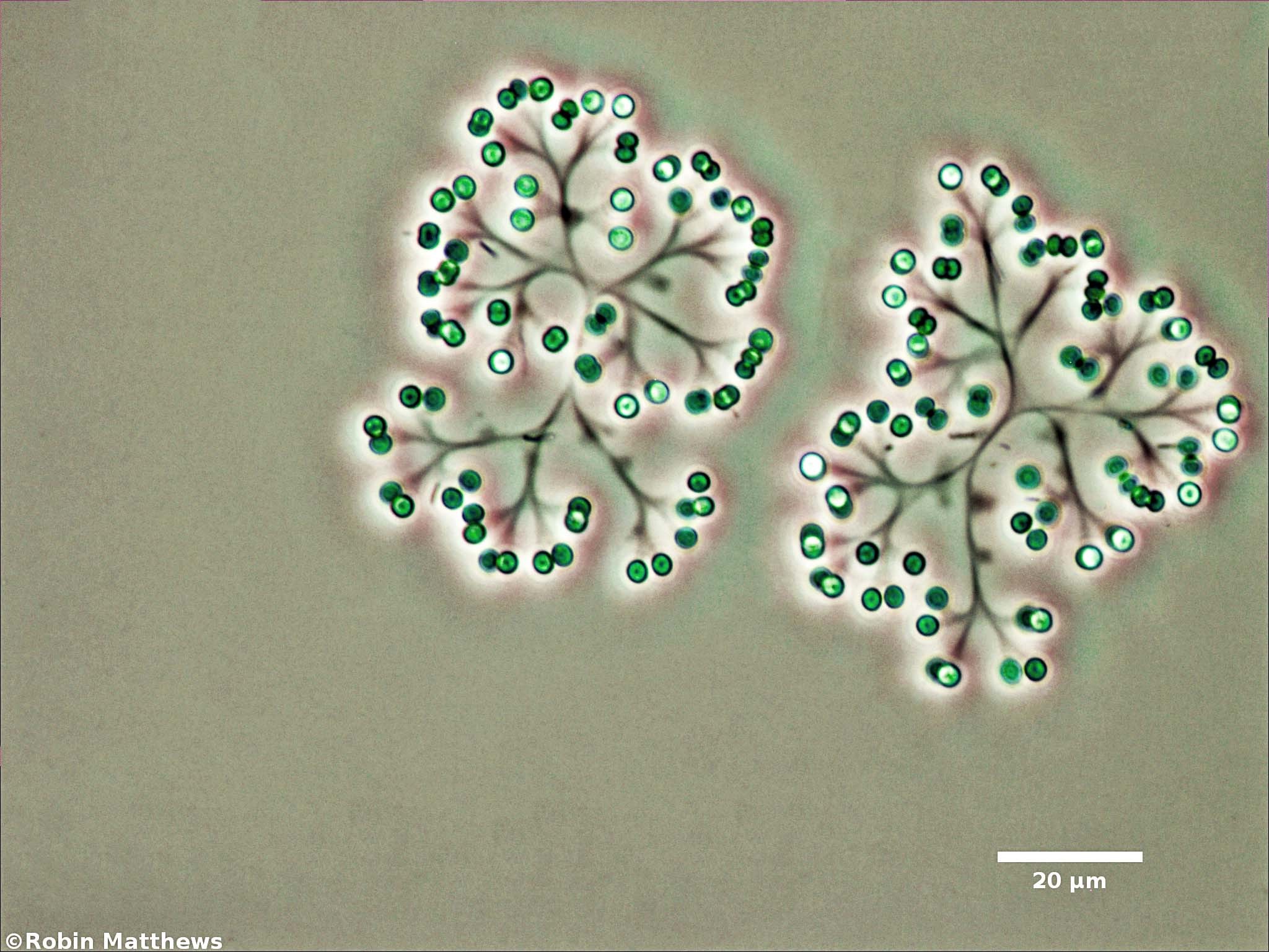 Cyanobacteria/Synechococcales/Coleosphaeriaceae/Snowella/litoralis/104.jpg