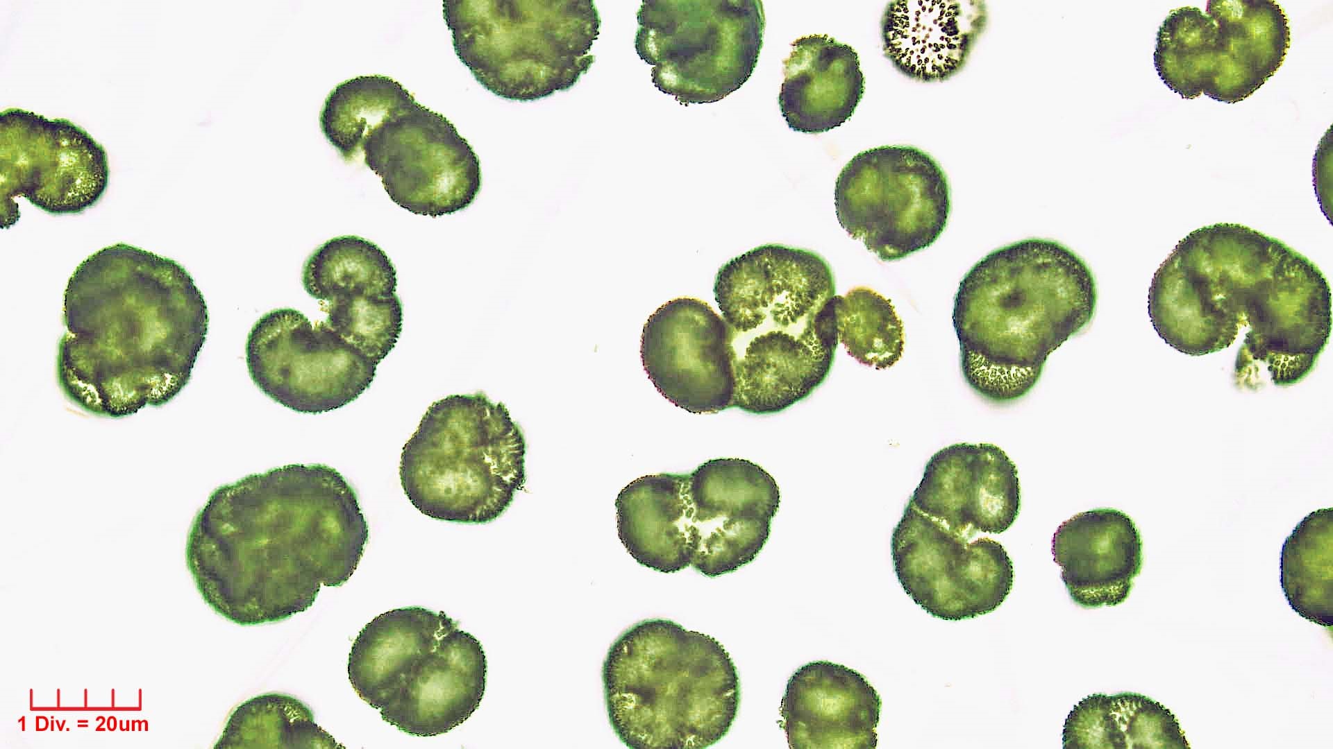 ././Cyanobacteria/Synechococcales/Coleosphaeriaceae/Woronichinia/naegeliana/105.jpg