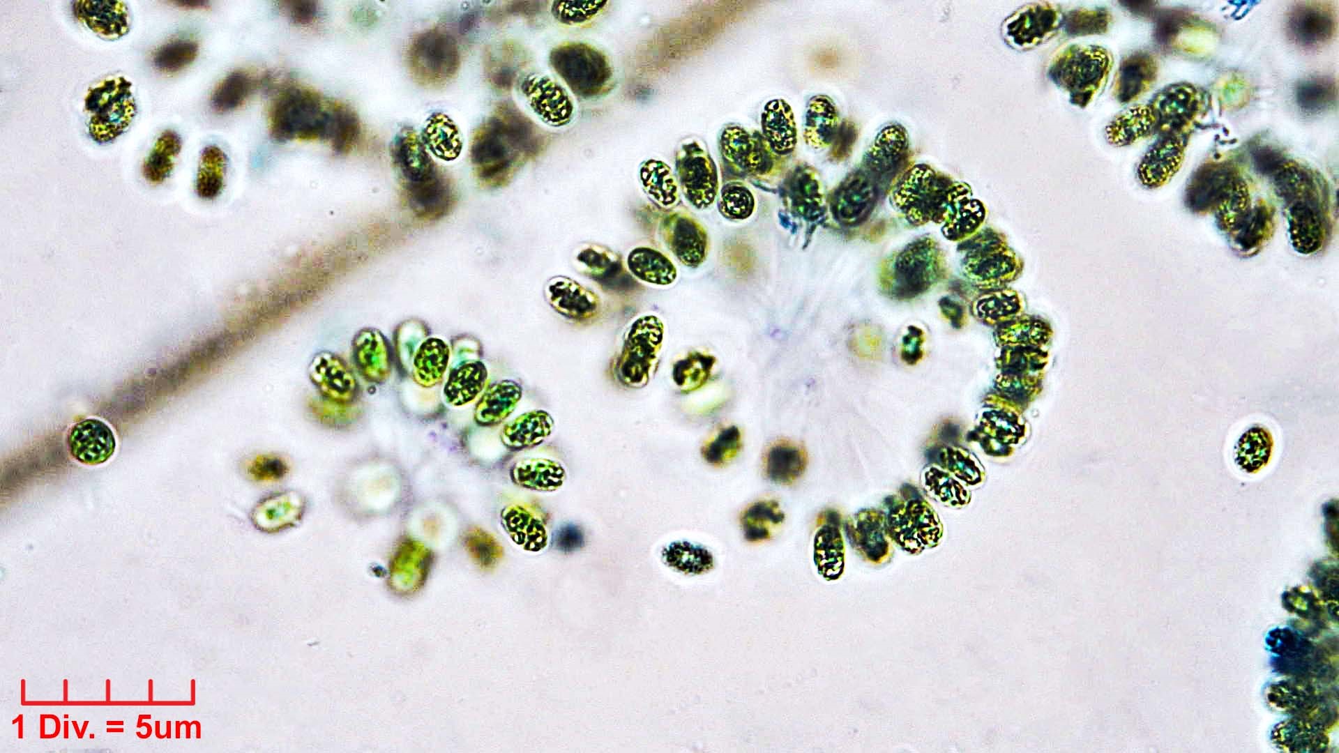 ./././Cyanobacteria/Synechococcales/Coleosphaeriaceae/Woronichinia/naegeliana/107.jpg