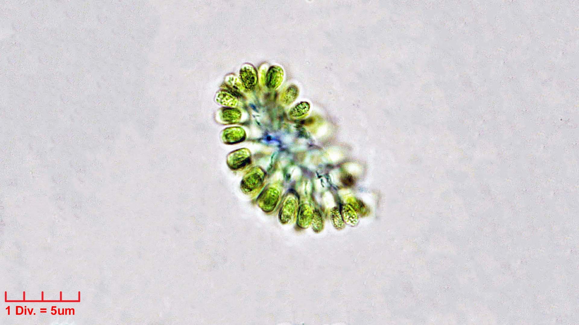 Cyanobacteria/Synechococcales/Coleosphaeriaceae/Woronichinia/naegeliana/108.jpg