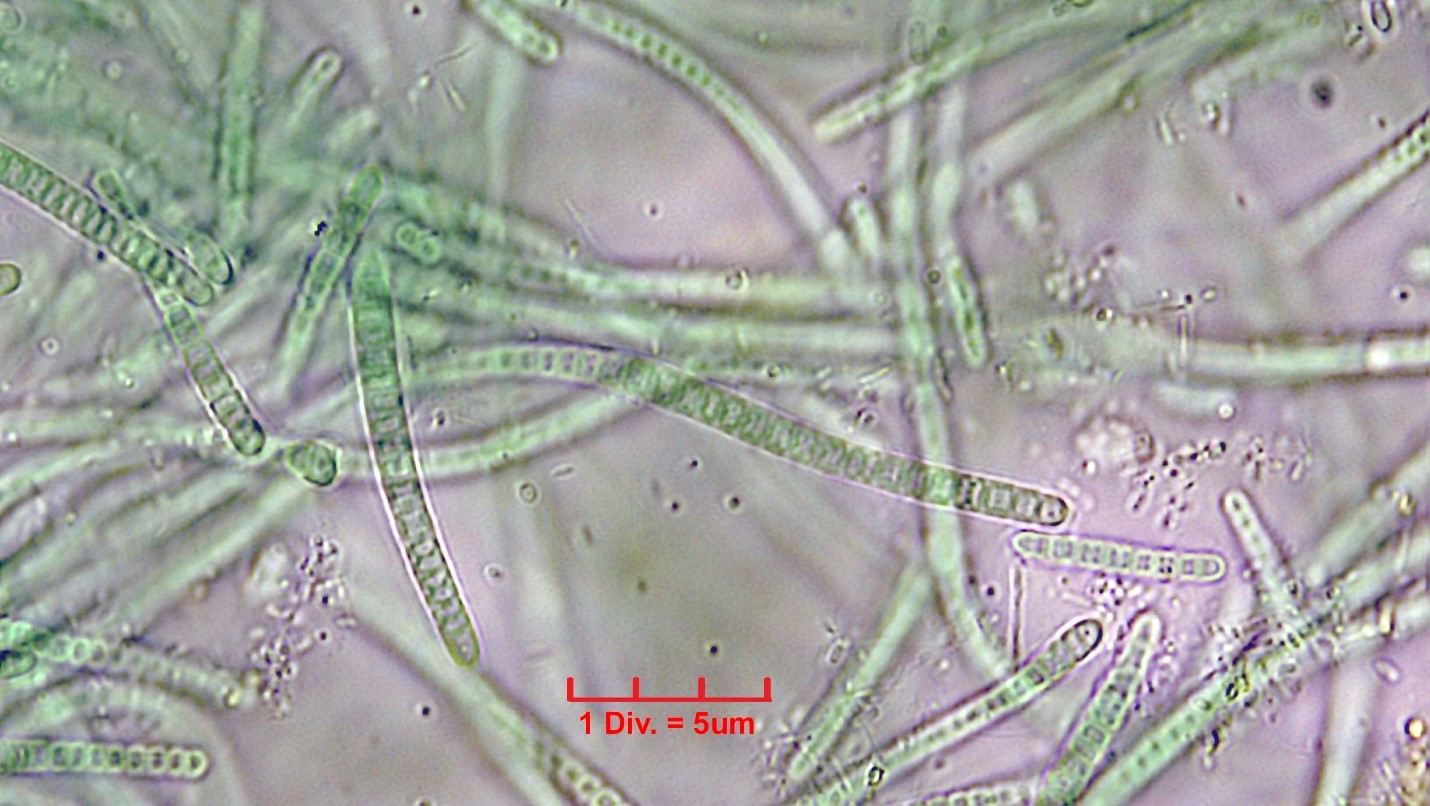 Cyanobacteria/Synechococcales/Leptolyngbyaceae/Leptolyngbya/foveolarum_cf/121.jpg