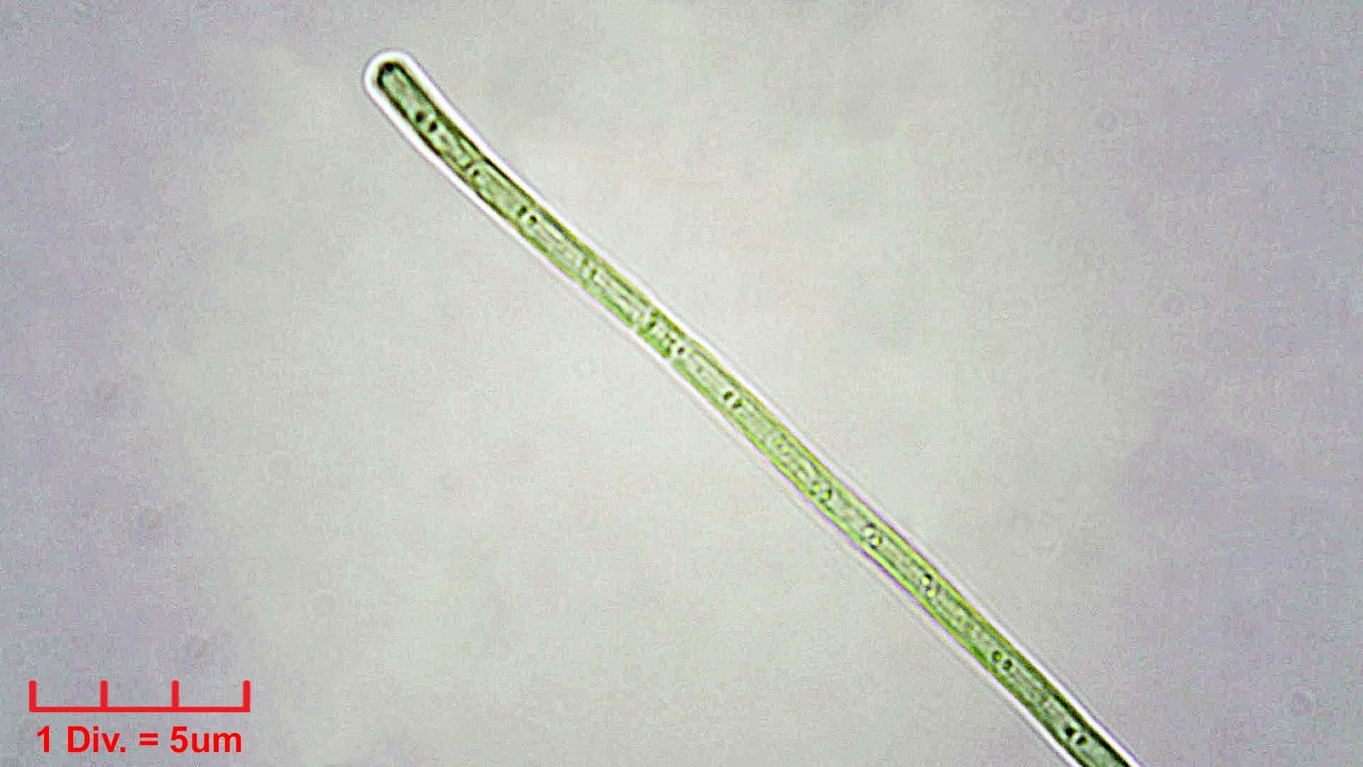Cyanobacteria/Synechococcales/Pseudanabaenaceae/Limnothrix/redekei/141.jpg