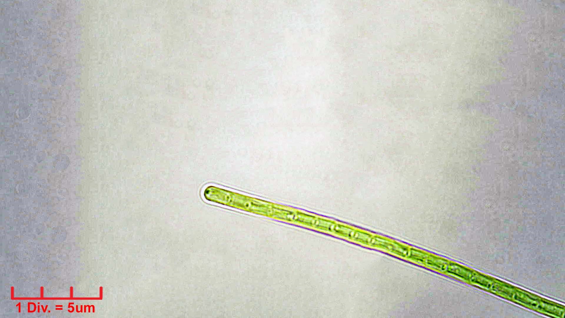 ././Cyanobacteria/Synechococcales/Pseudanabaenaceae/Limnothrix/redekei/142.jpg