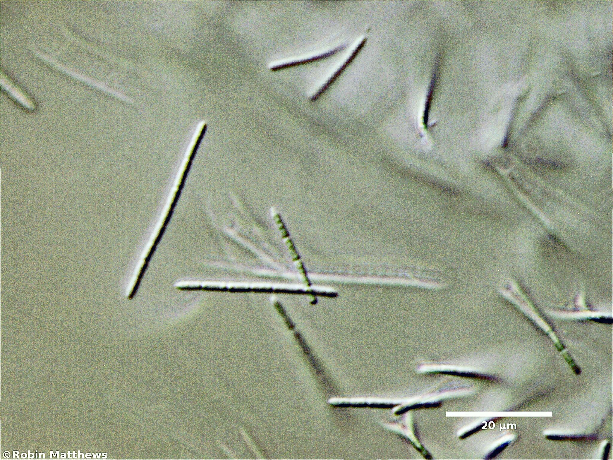 Cyanobacteria/Synechococcales/Pseudanabaenaceae/Pseudanabaena/arcuata/133.jpg
