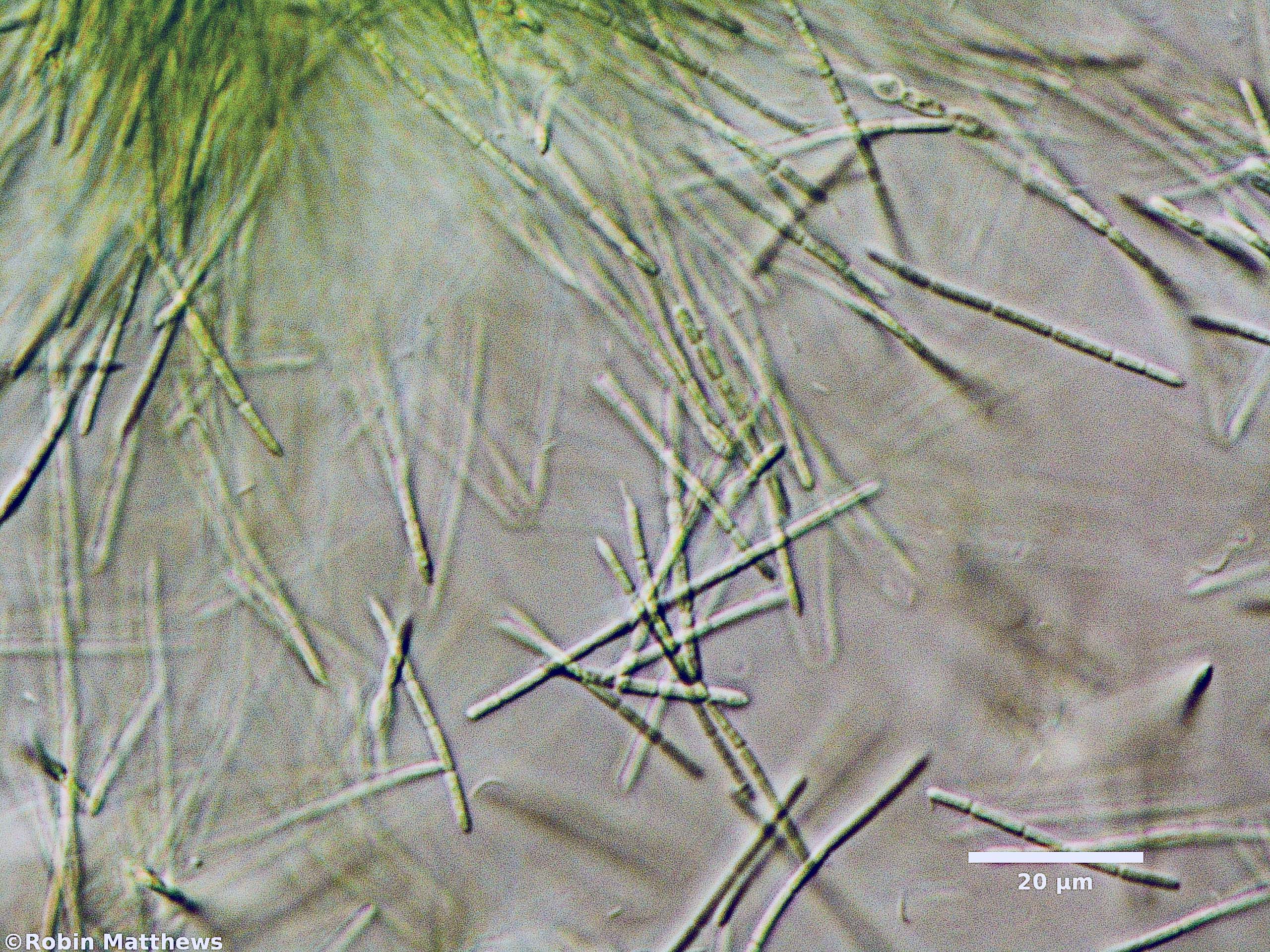 ./././Cyanobacteria/Synechococcales/Pseudanabaenaceae/Pseudanabaena/sp/131.jpg